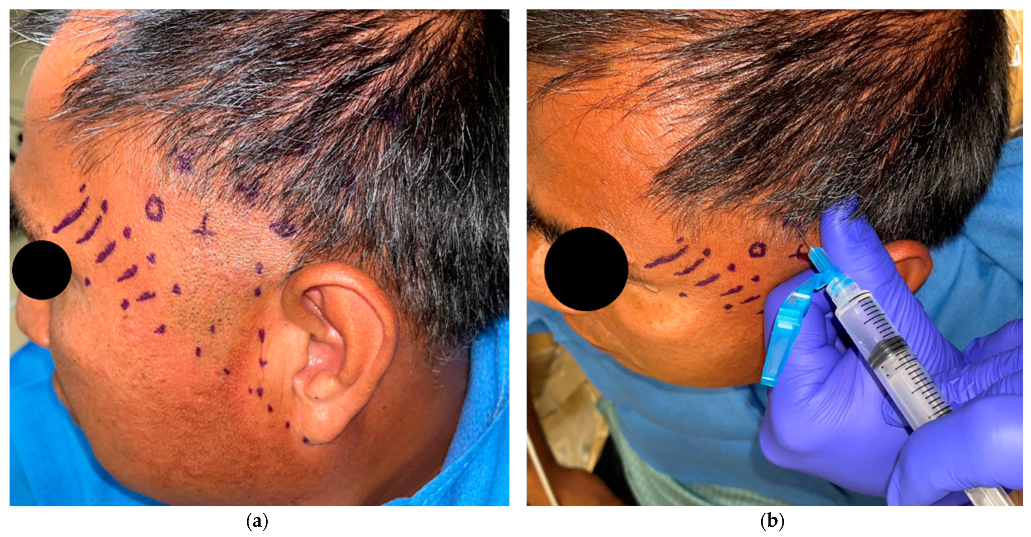 Dentistry 11 00003 g002