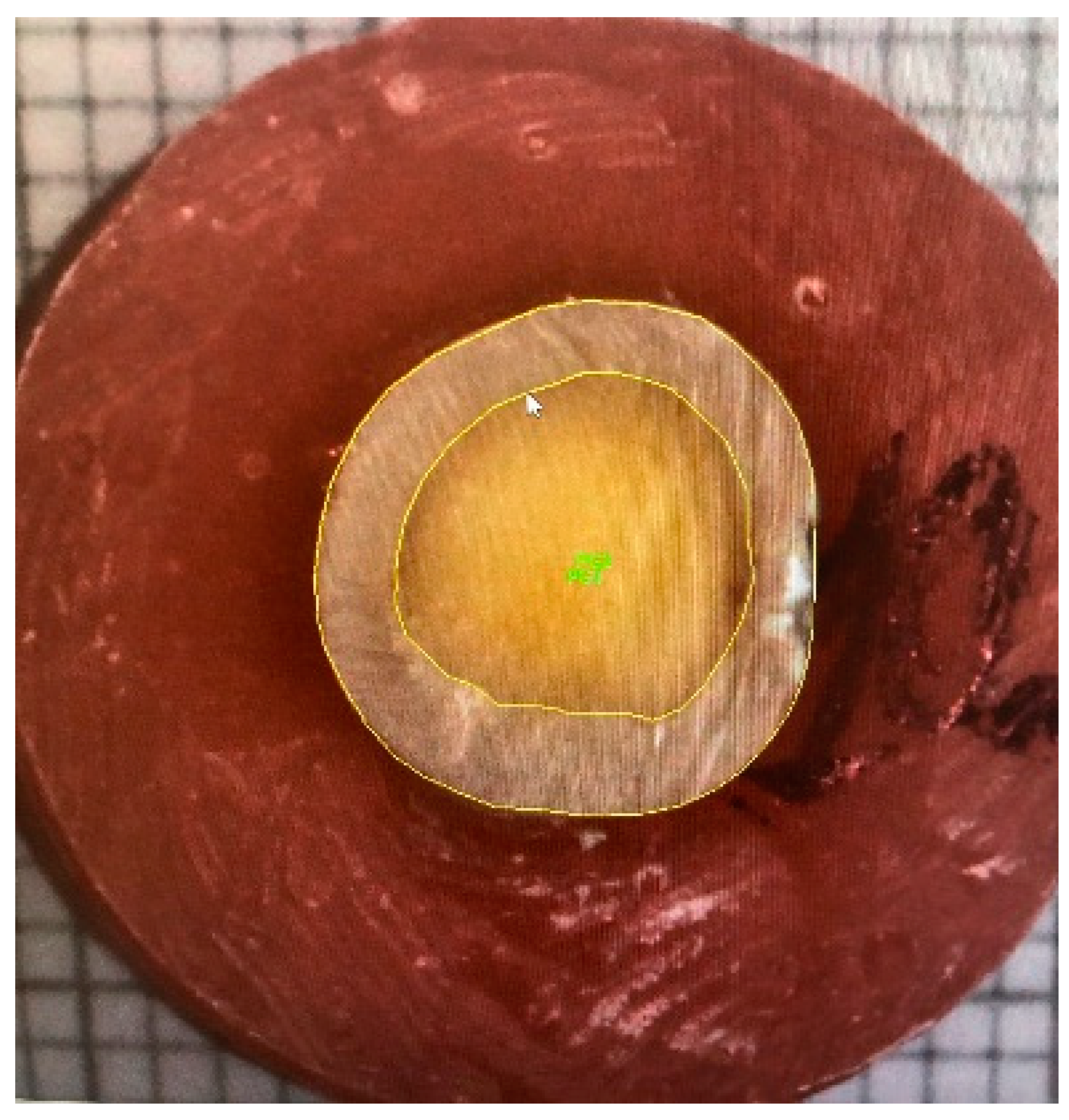 Dentistry 11 00019 g003 Dentistry 11 00019 g003