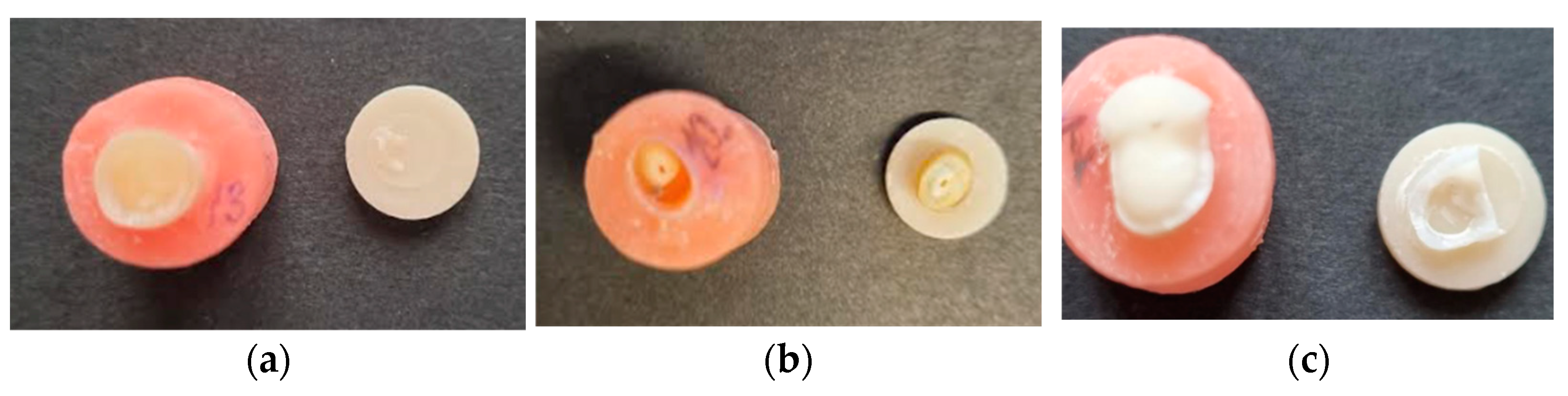 Dentistry 11 00019 g006 Dentistry 11 00019 g006