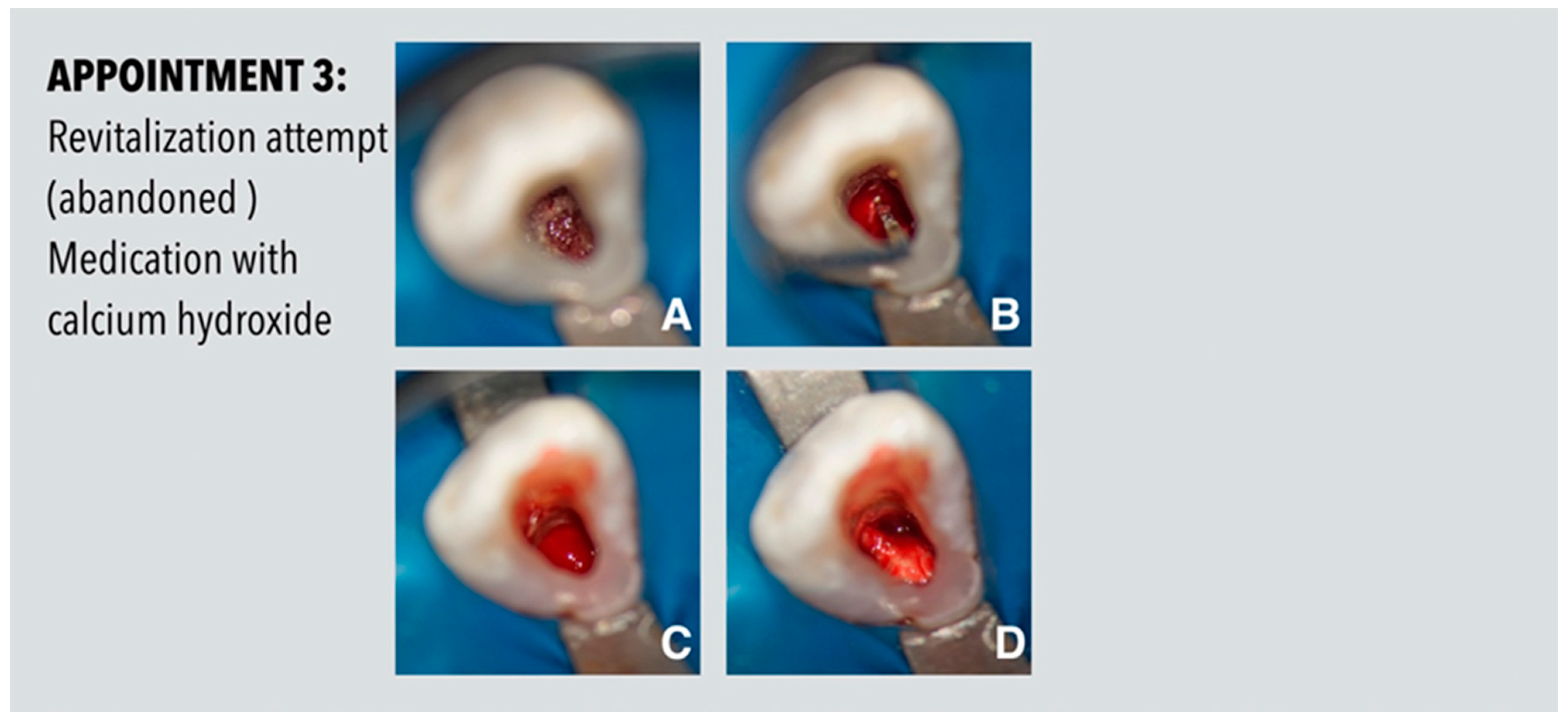 Dentistry 11 00047 g003