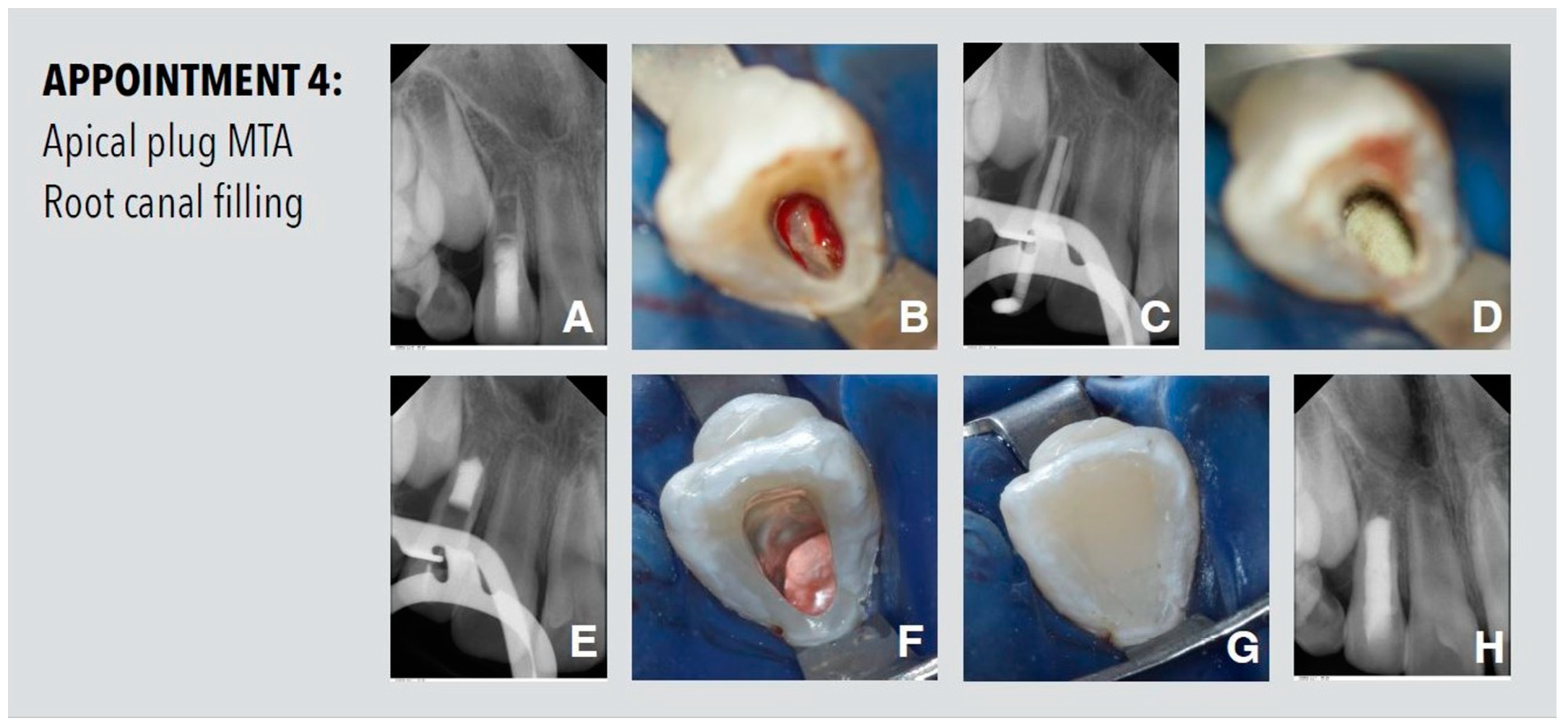 Dentistry 11 00047 g004
