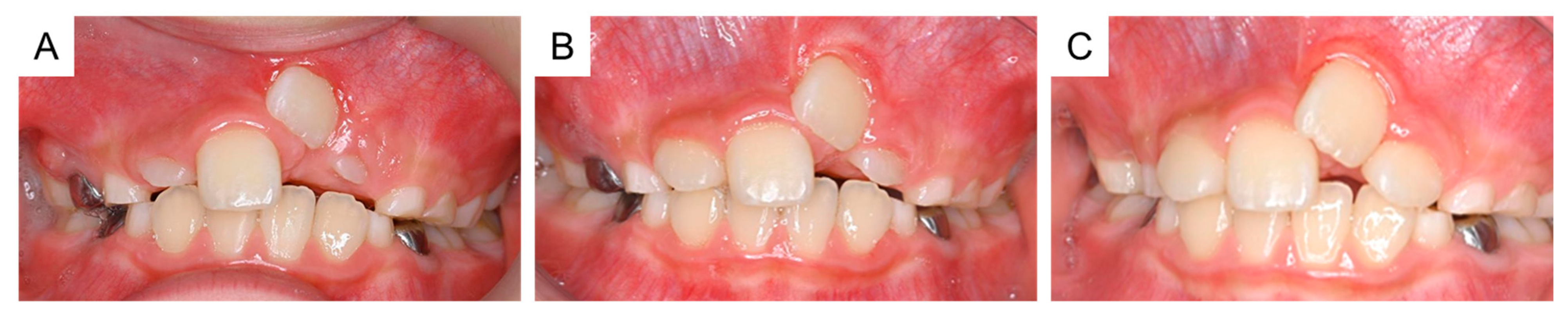 Dentistry 11 00049 g006