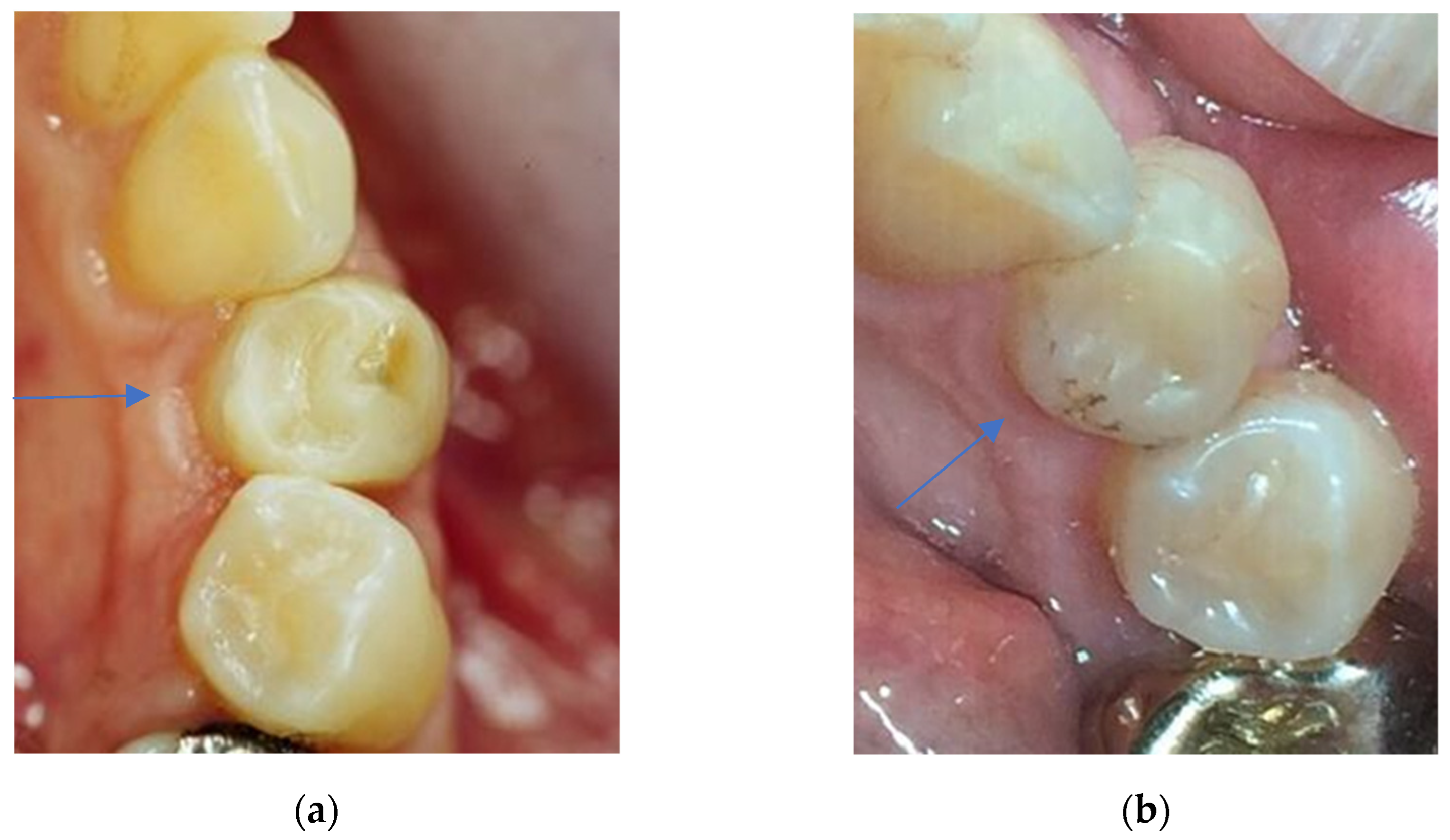 Dentistry 11 00069 g005
