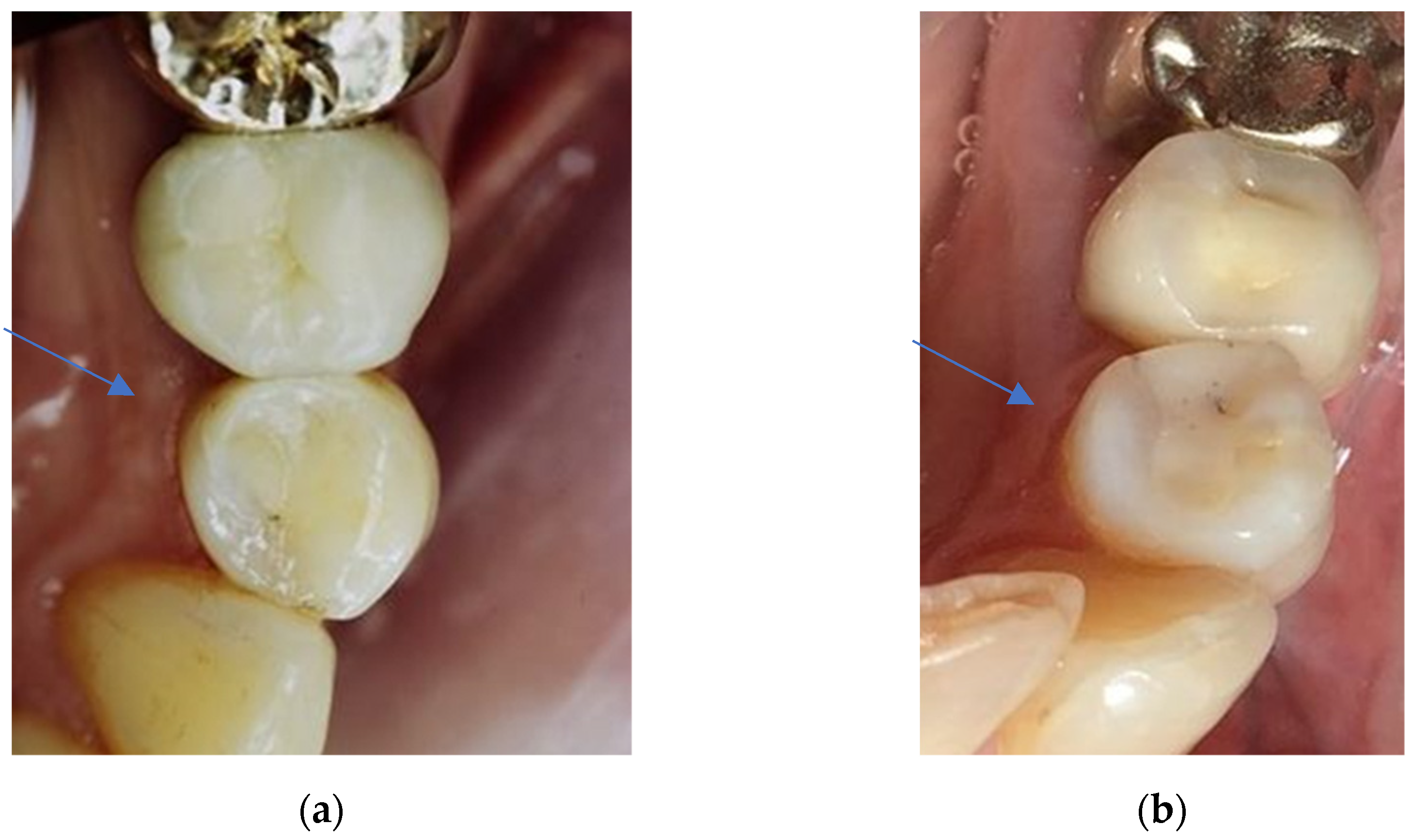 Dentistry 11 00069 g006