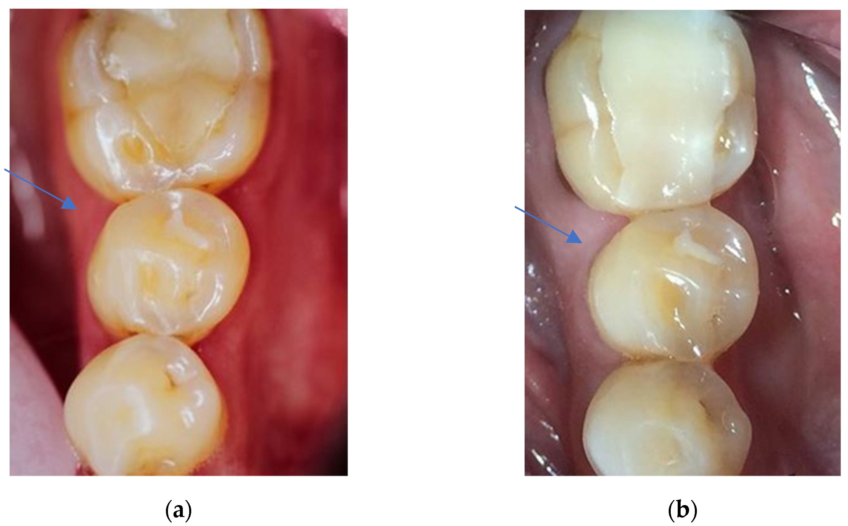 Dentistry 11 00069 g007