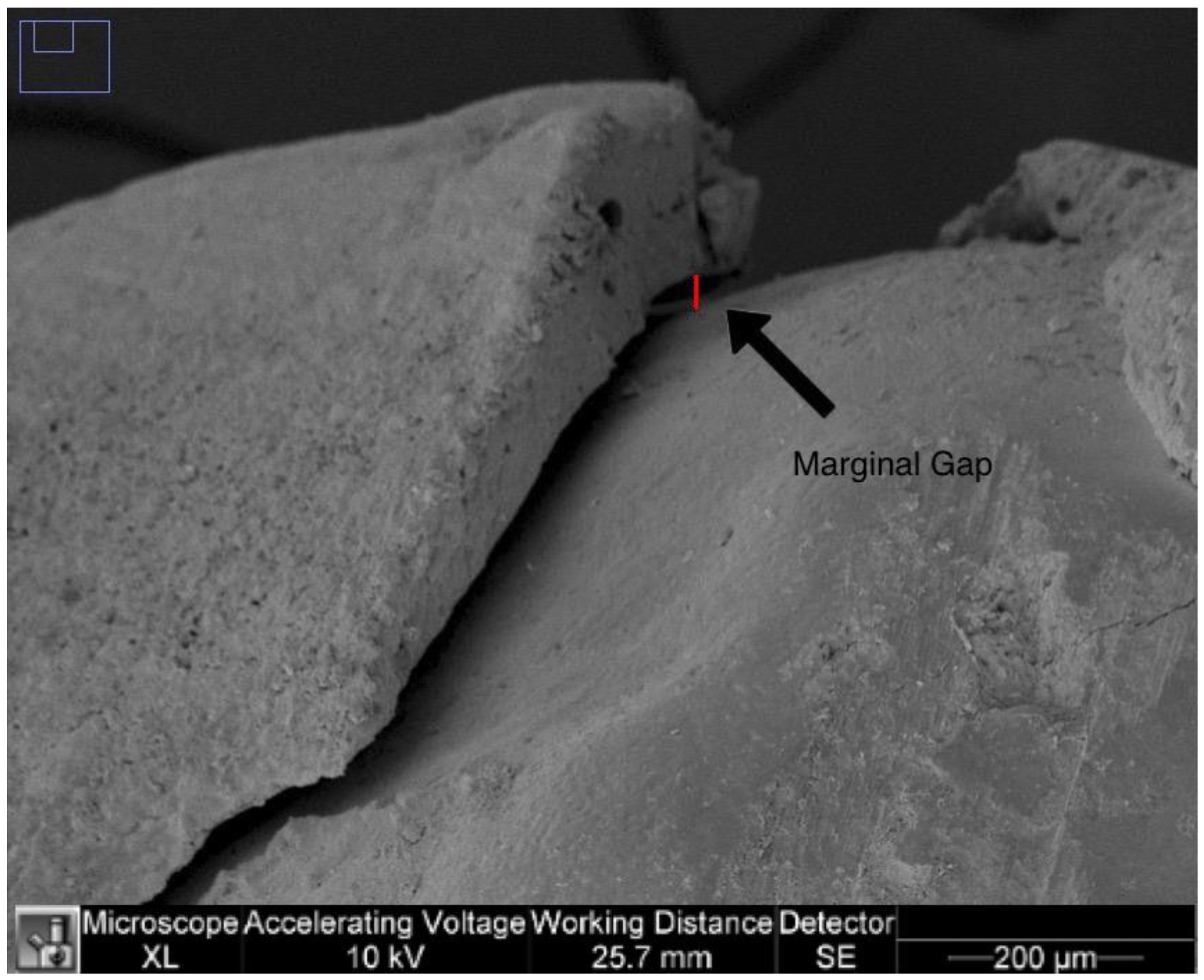 Dentistry 11 00077 g002 Dentistry 11 00077 g002