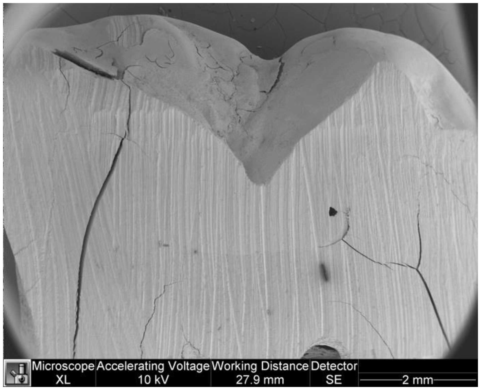 Dentistry 11 00077 g006 Dentistry 11 00077 g006