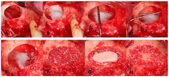 Dentistry 11 00084 g005