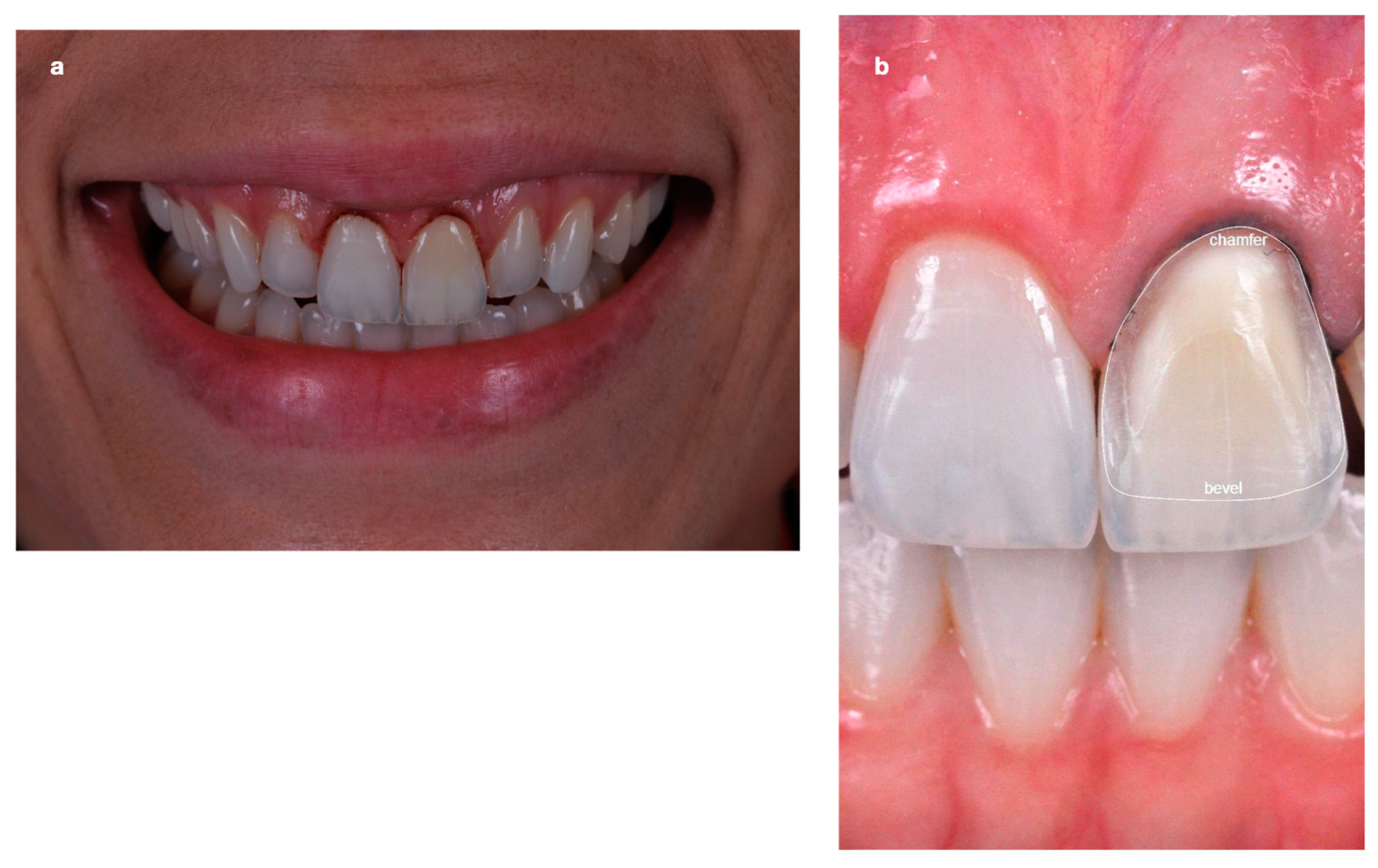 Dentistry 11 00101 g004