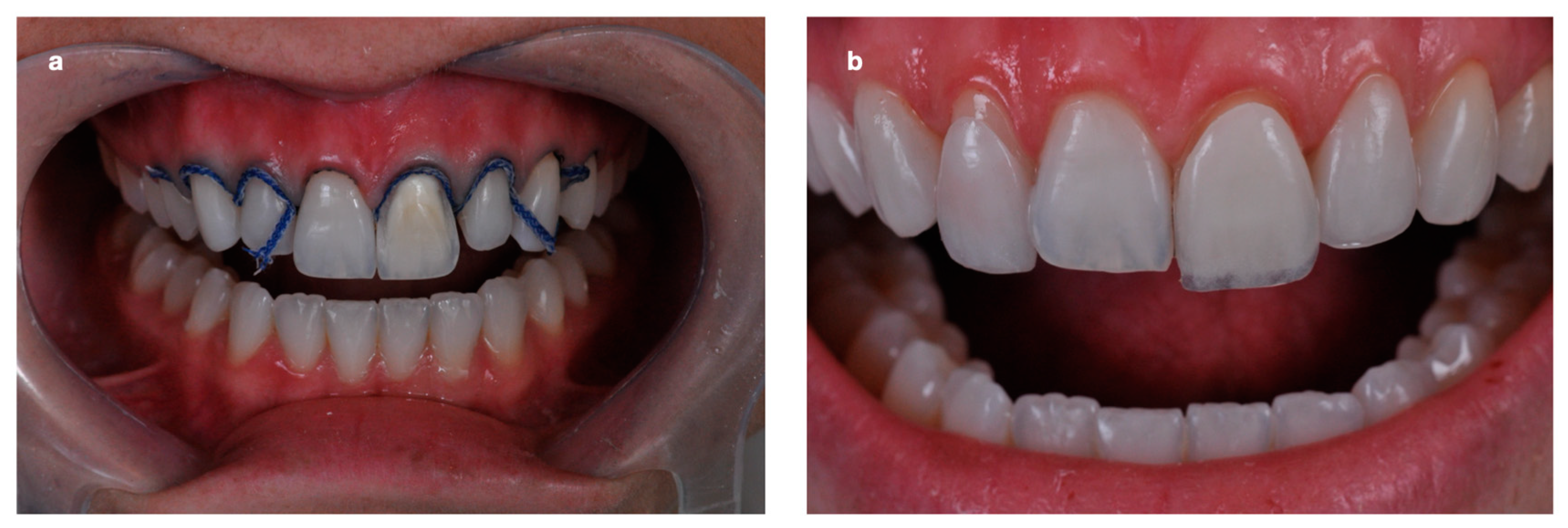 Dentistry 11 00101 g005