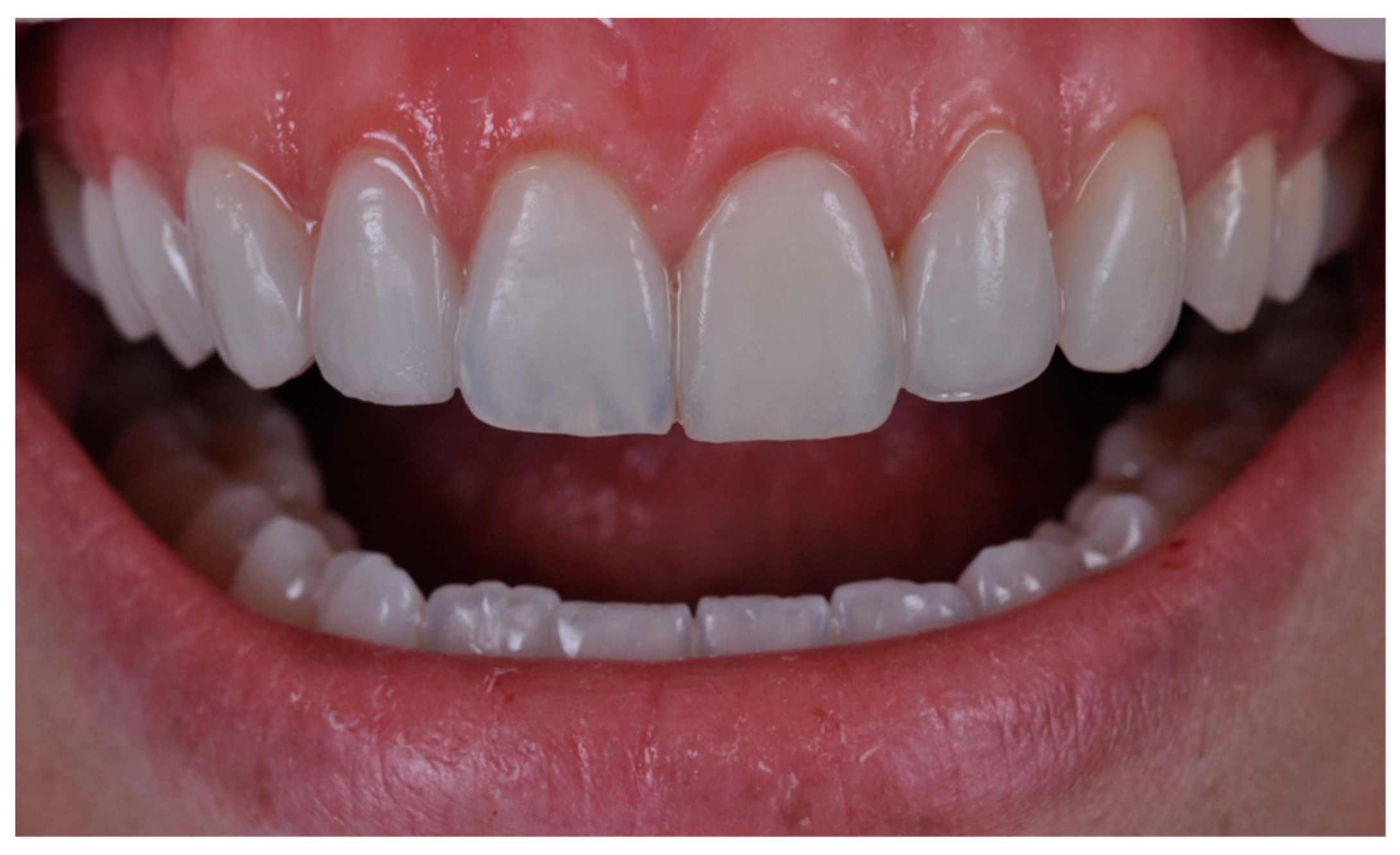 Dentistry 11 00101 g006