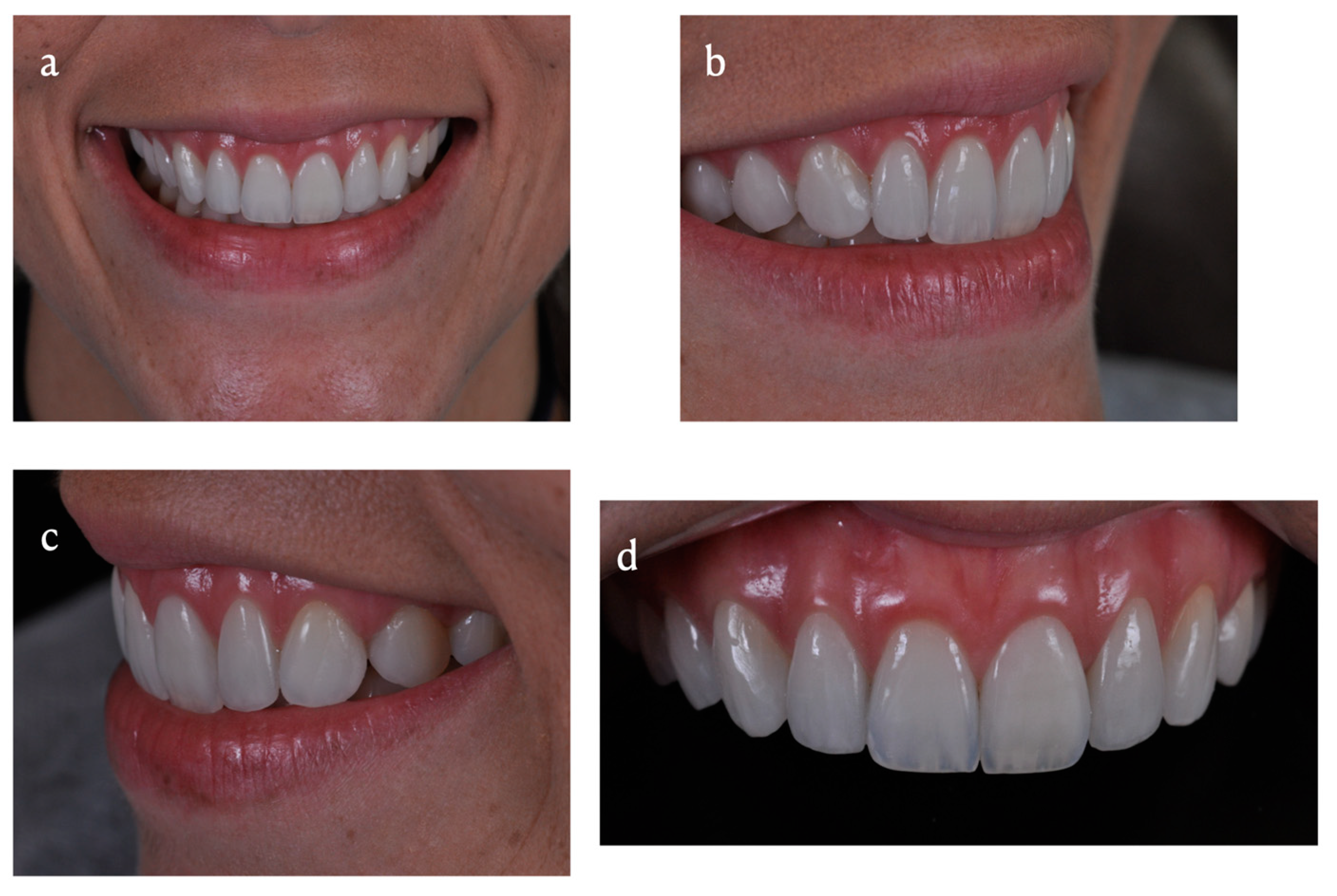 Dentistry 11 00101 g007