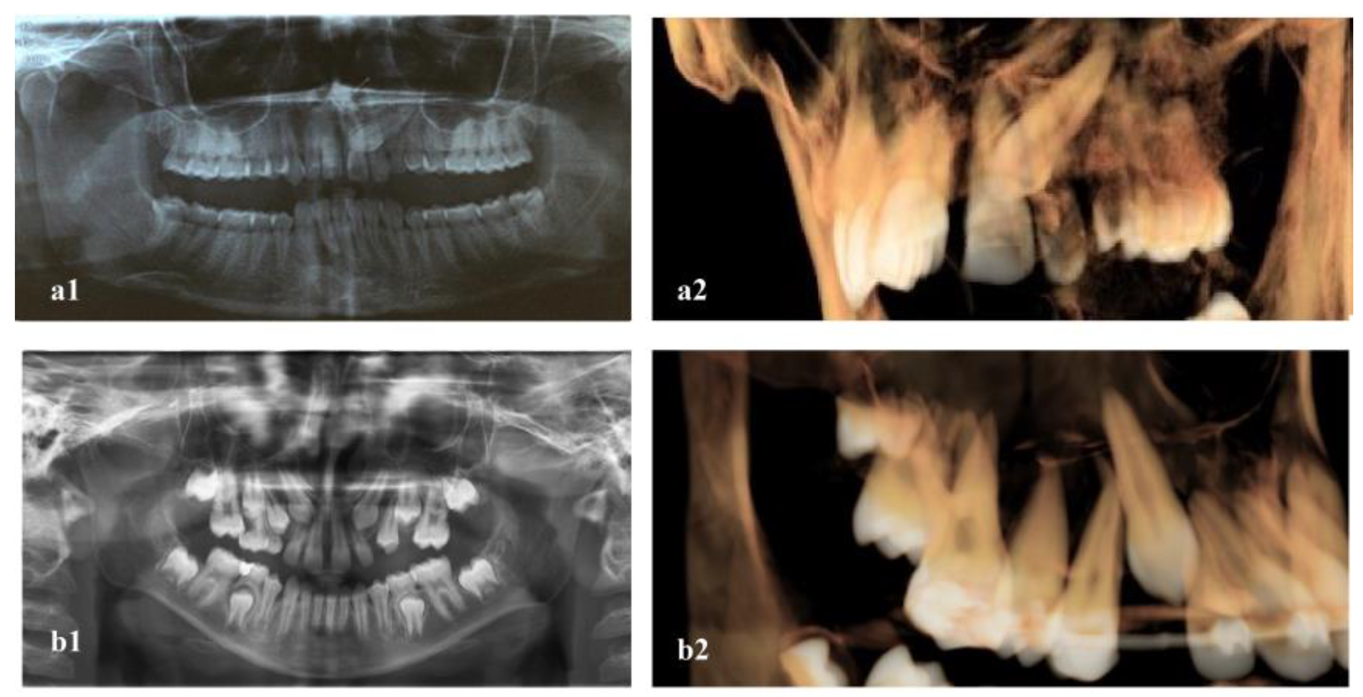 Dentistry 11 00102 g001 Dentistry 11 00102 g001