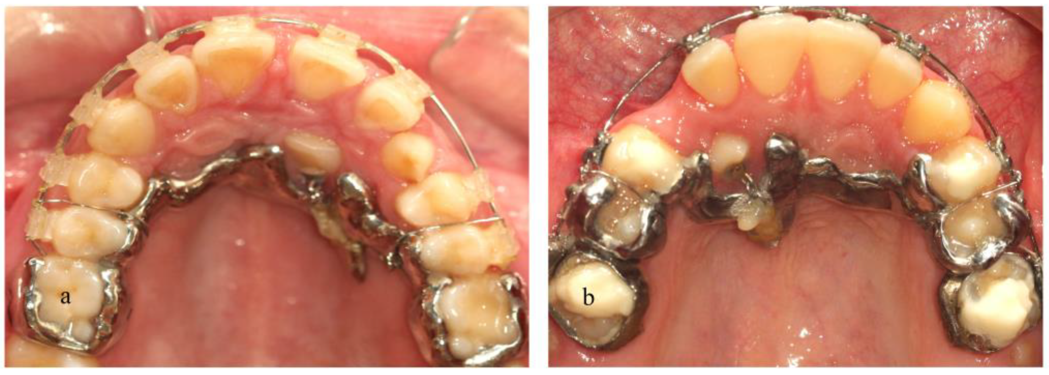 Dentistry 11 00102 g008 Dentistry 11 00102 g008