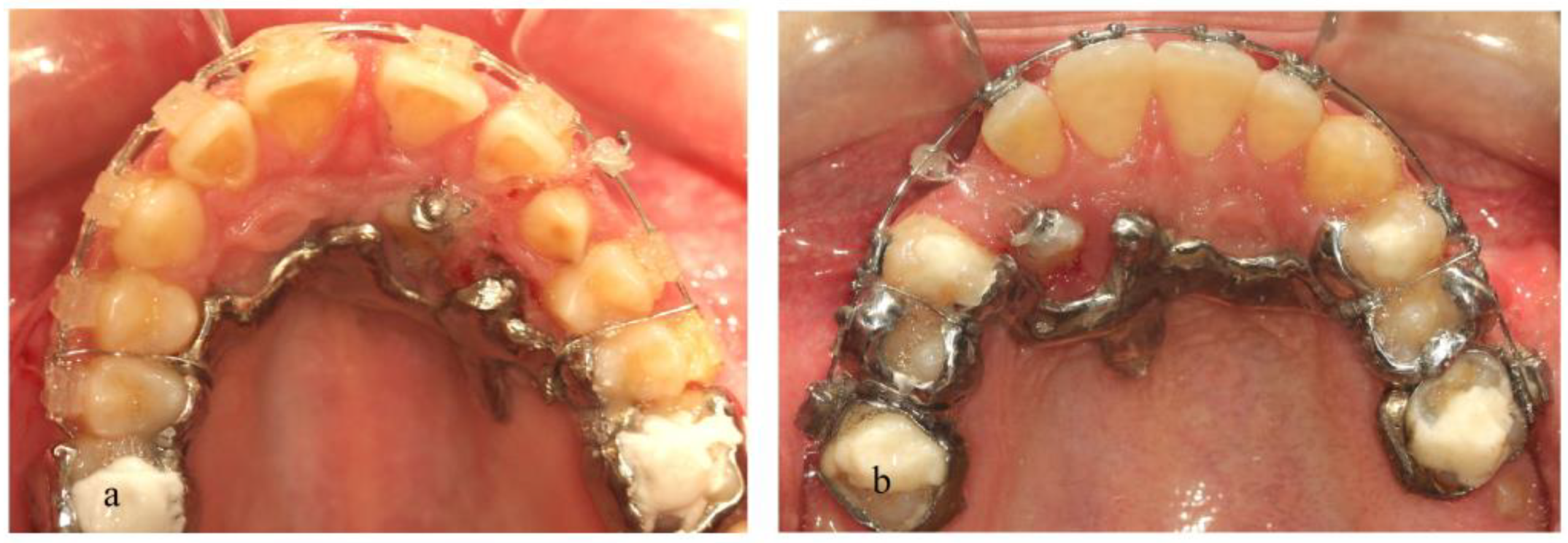 Dentistry 11 00102 g009 Dentistry 11 00102 g009