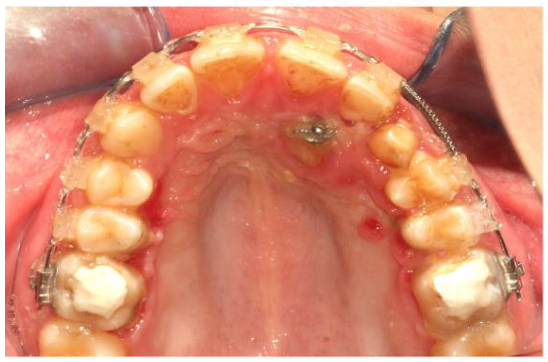 Dentistry 11 00102 g010 Dentistry 11 00102 g010