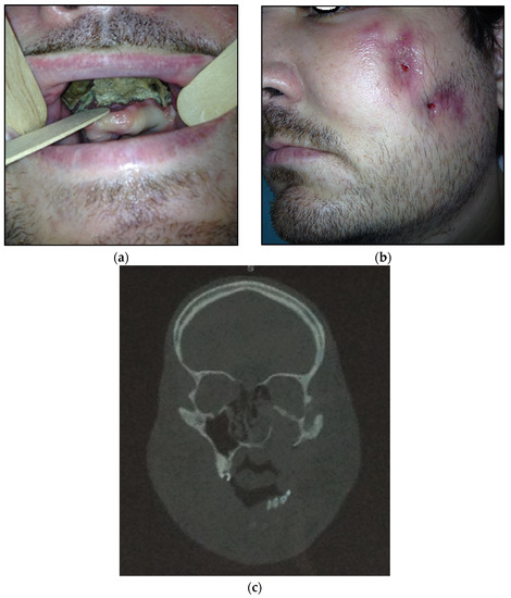 Dentistry 11 00108 g003