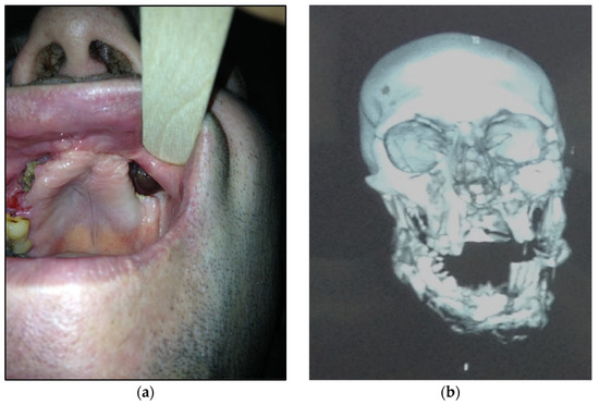 Dentistry 11 00108 g004
