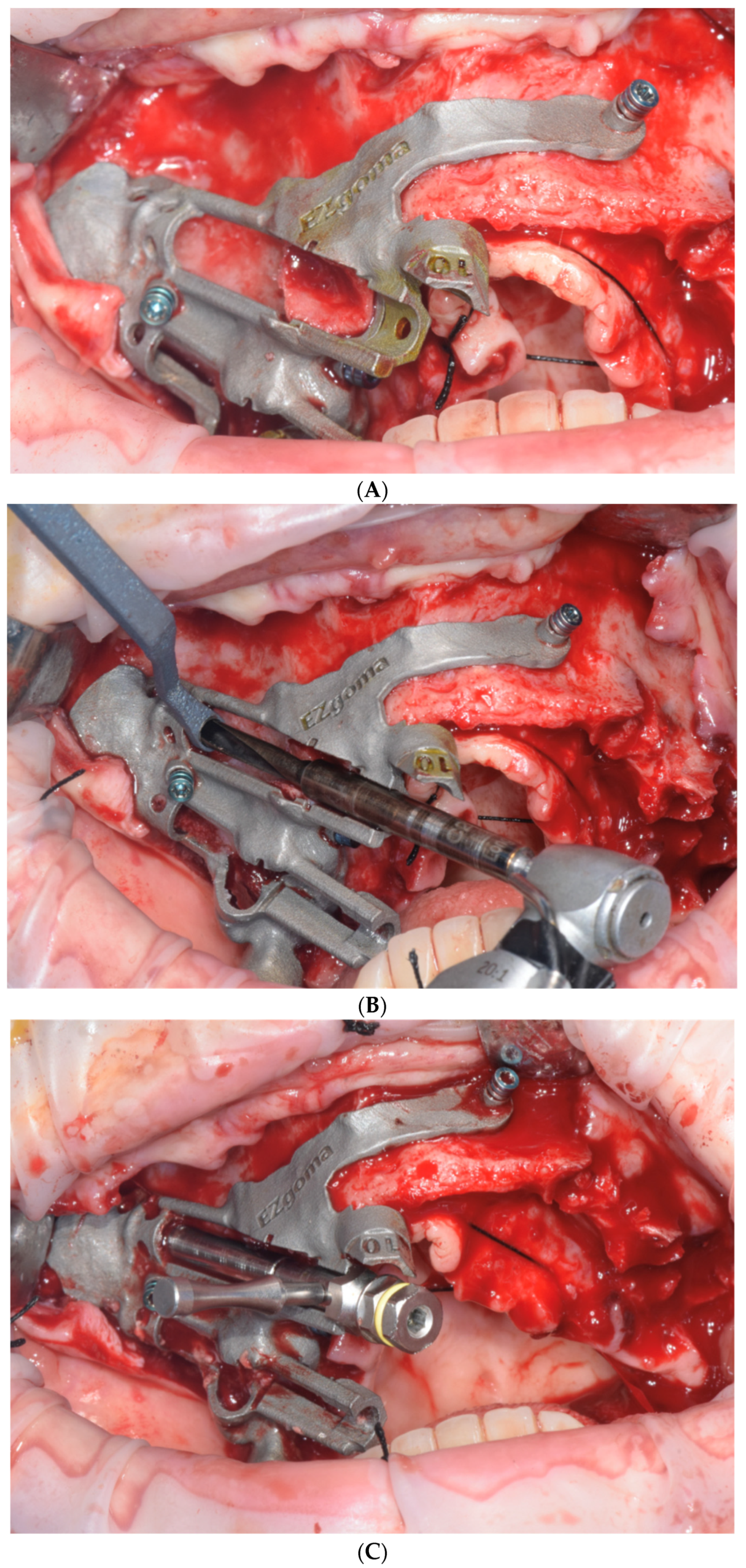 Dentistry 11 00123 g002