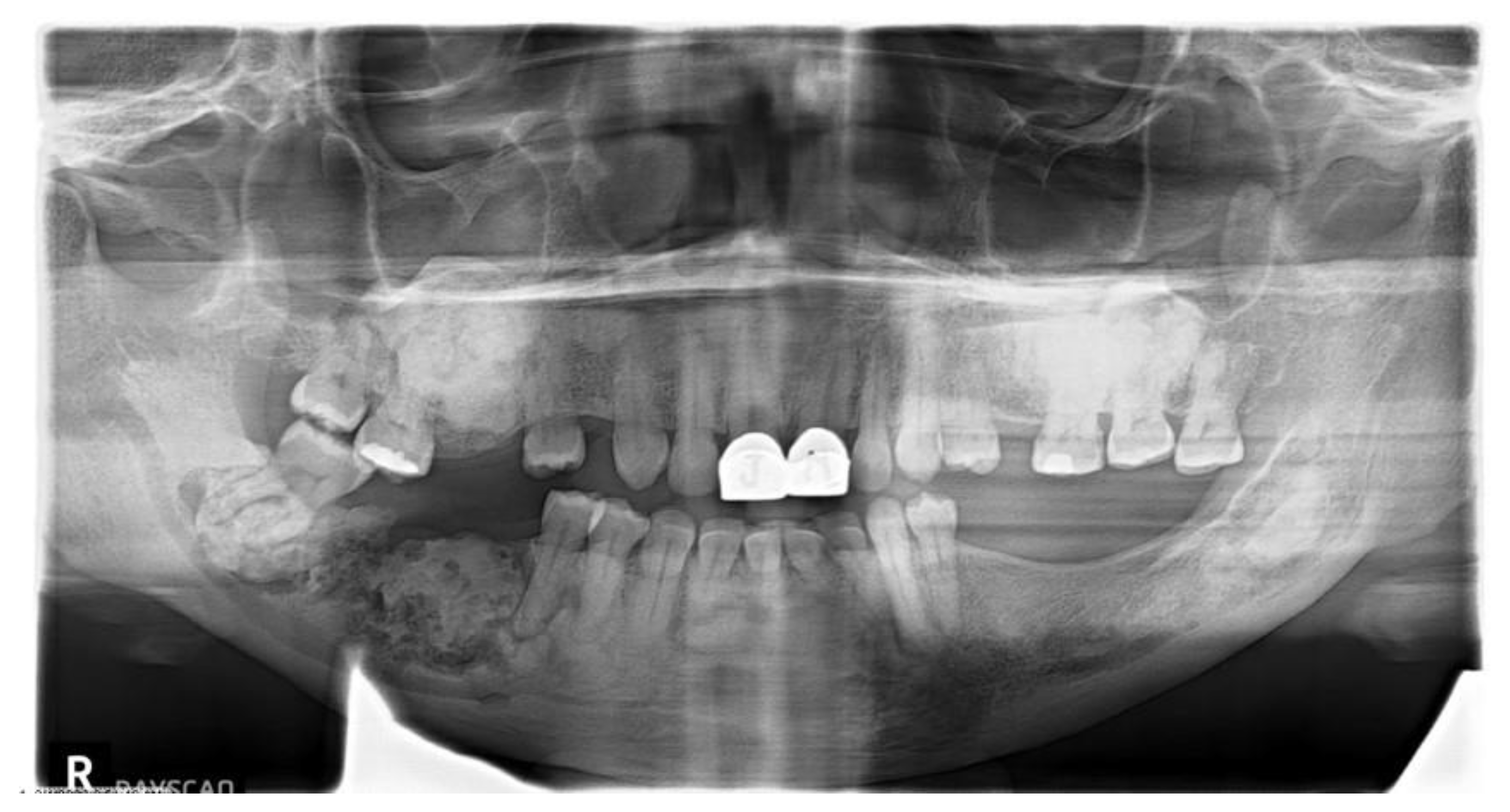Dentistry 11 00138 g001 Dentistry 11 00138 g001