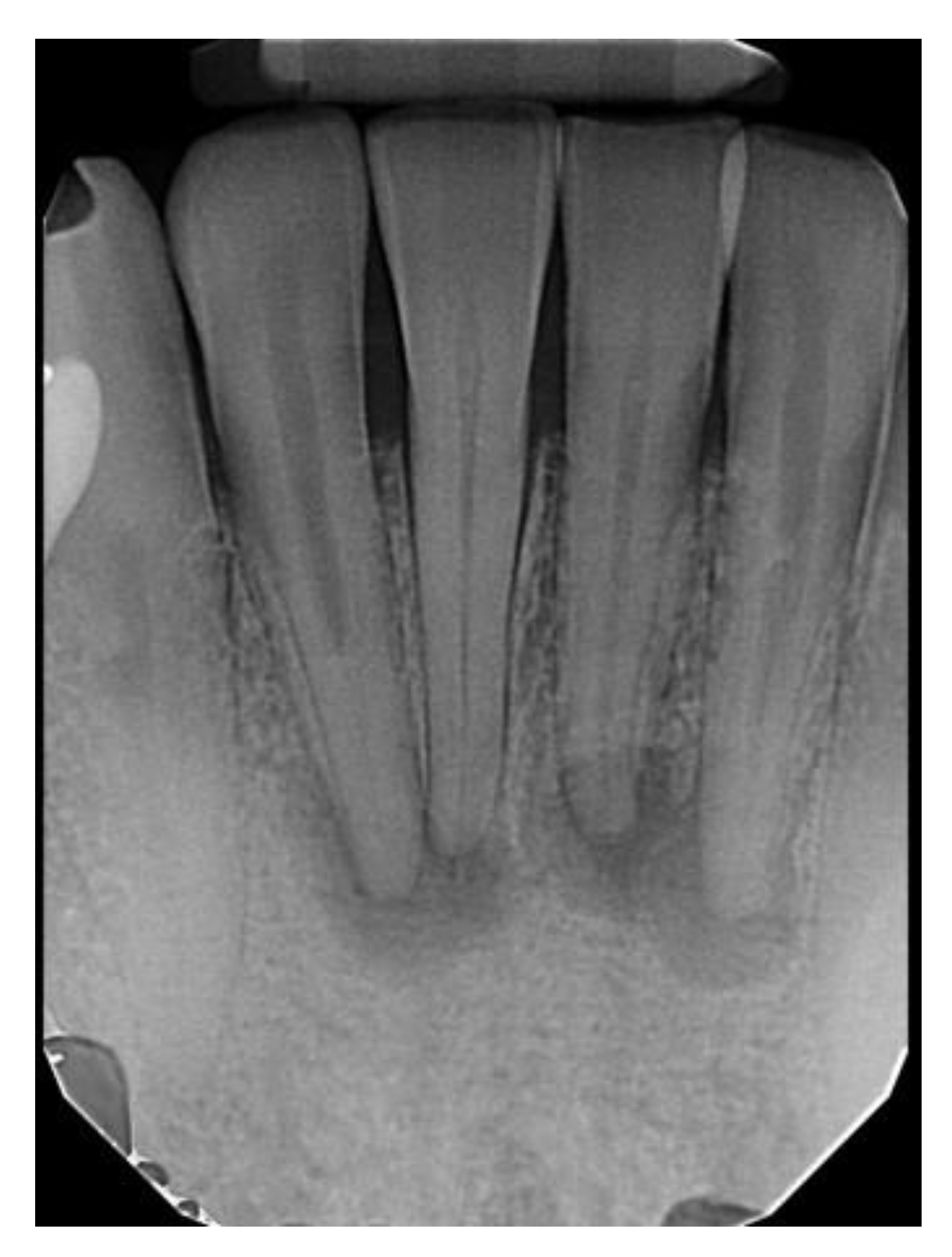 Dentistry 11 00138 g003 Dentistry 11 00138 g003