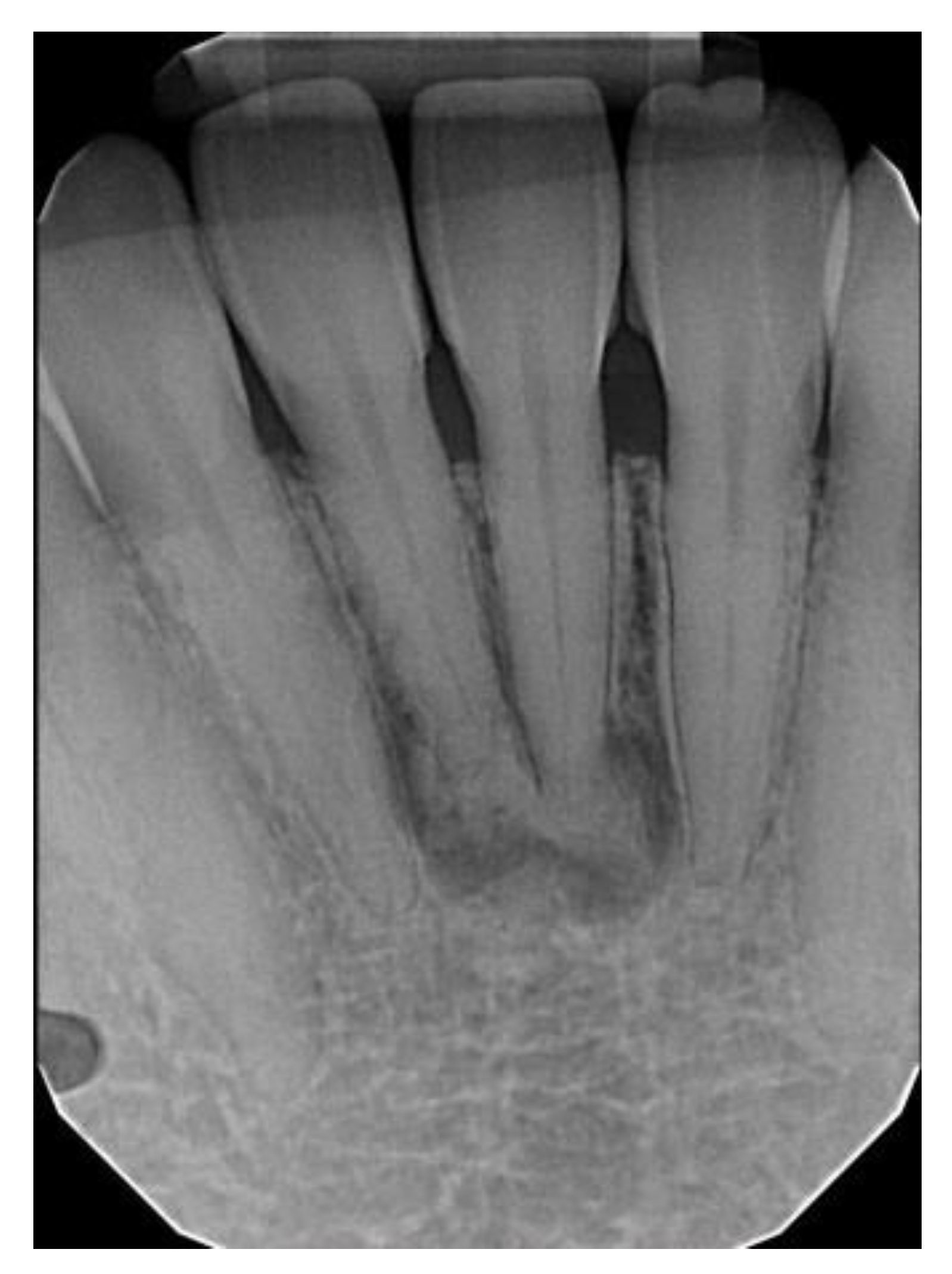 Dentistry 11 00138 g004 Dentistry 11 00138 g004