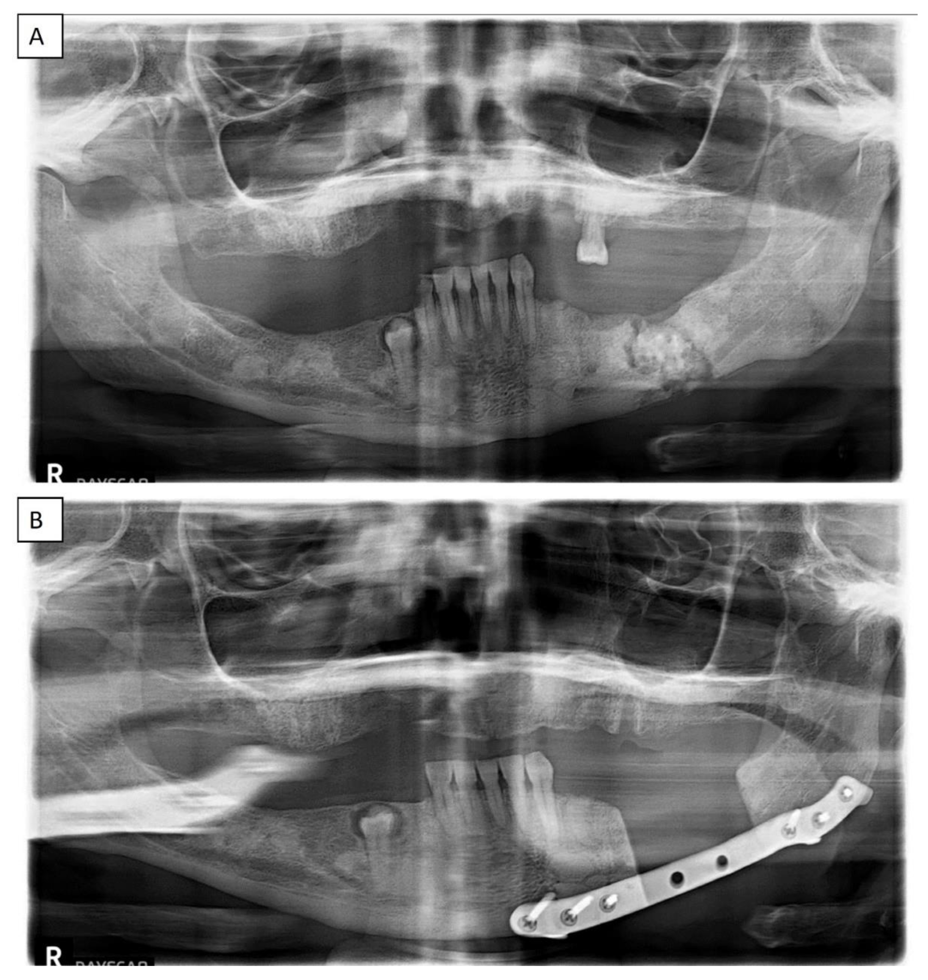Dentistry 11 00138 g007 Dentistry 11 00138 g007