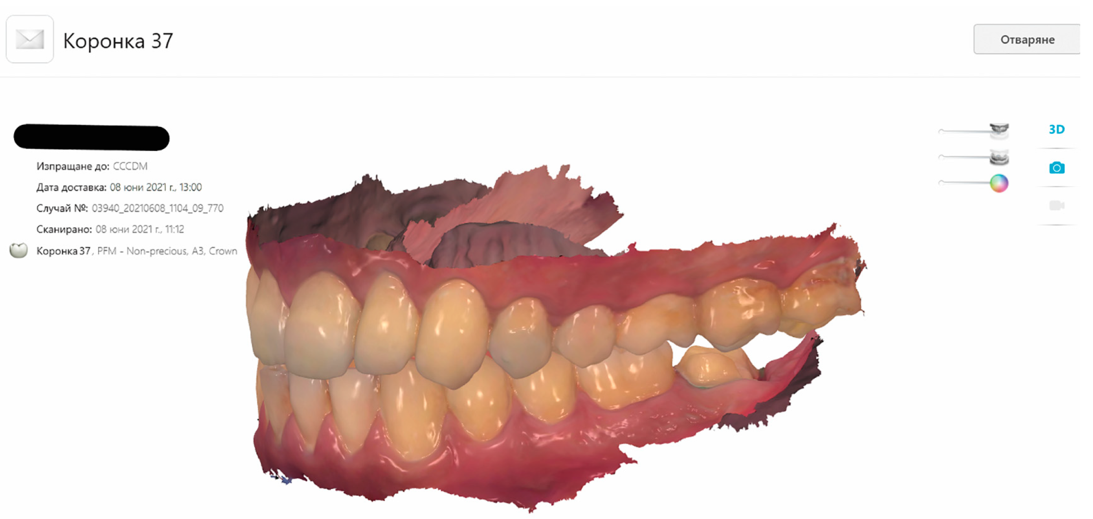 Dentistry 11 00166 g001