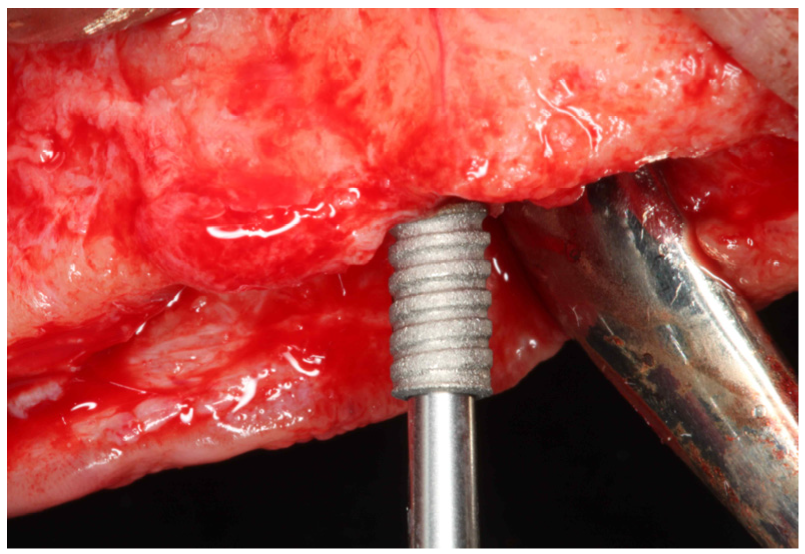 Dentistry 11 00177 g001 Dentistry 11 00177 g001