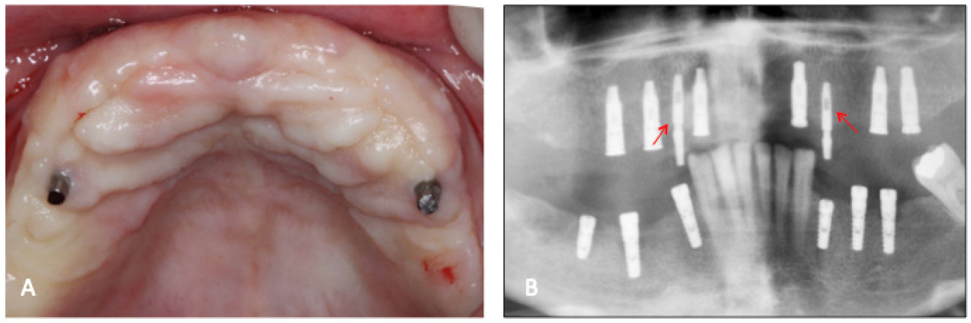 Dentistry 11 00177 g002 Dentistry 11 00177 g002