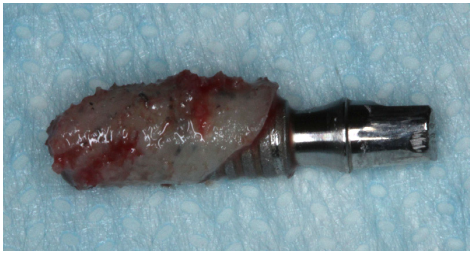 Dentistry 11 00177 g003 Dentistry 11 00177 g003