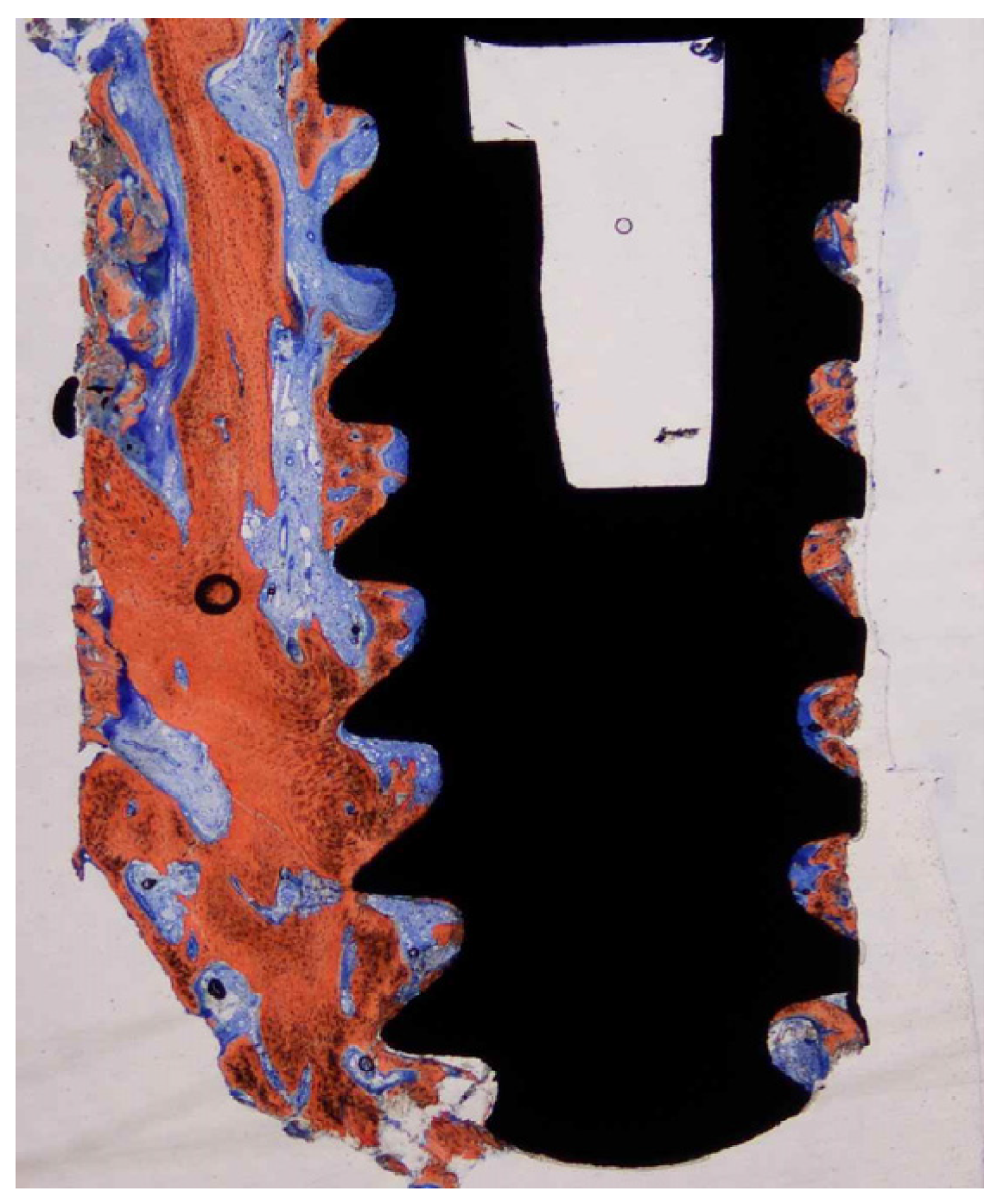 Dentistry 11 00177 g004 Dentistry 11 00177 g004