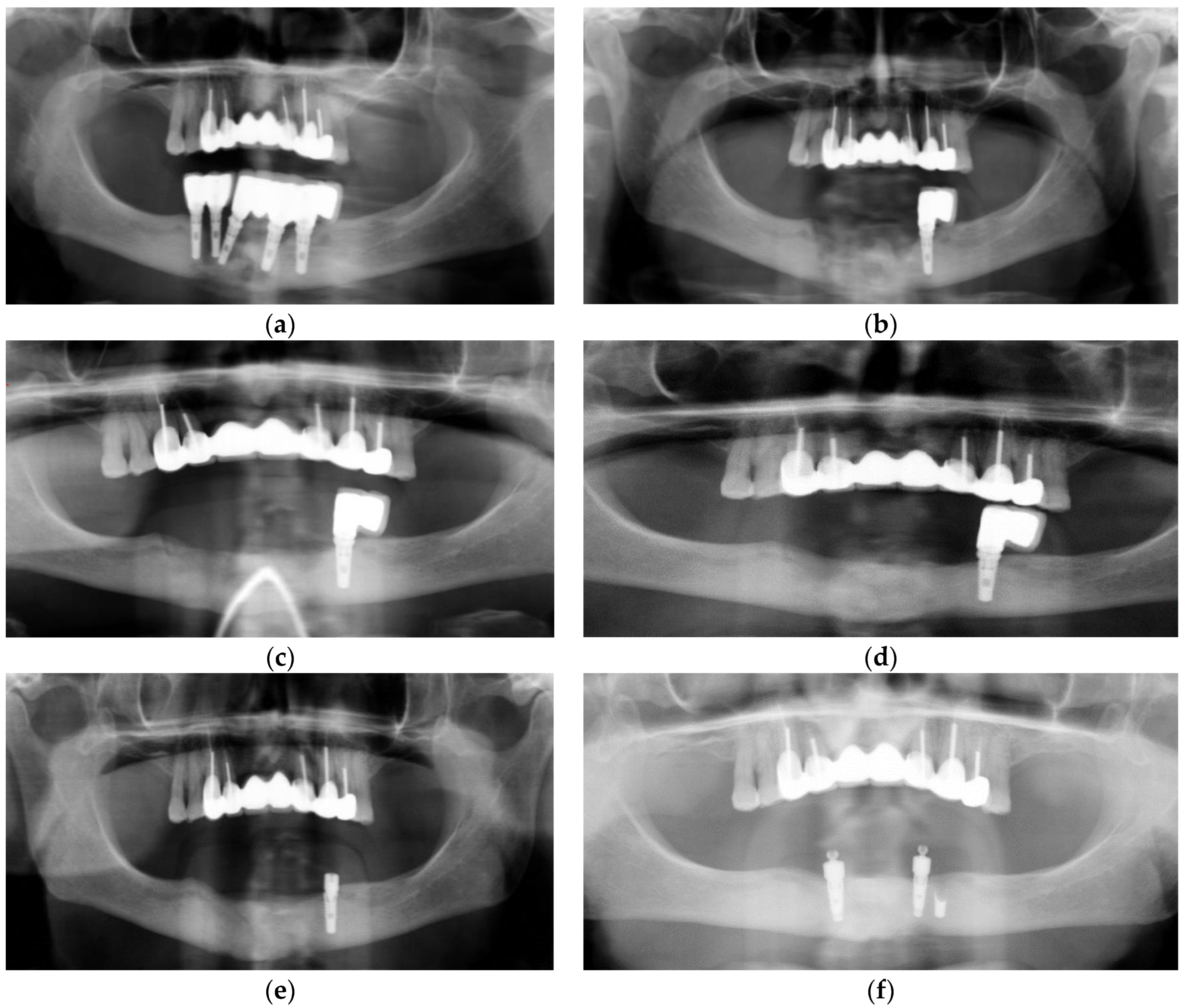 Dentistry 11 00184 g001