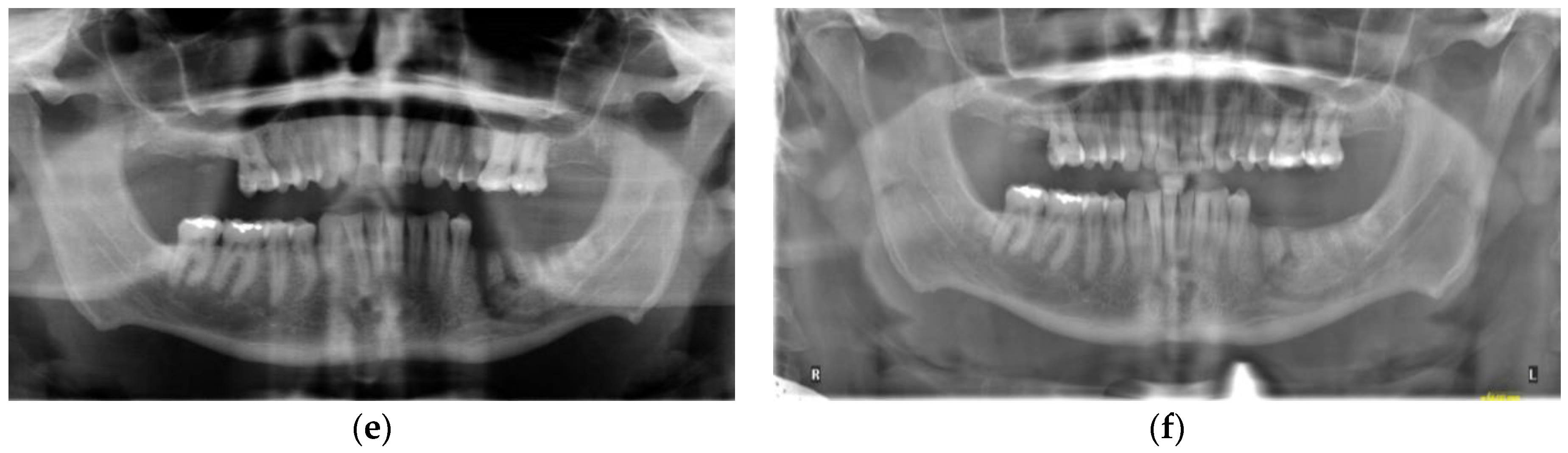 Dentistry 11 00184 g002b