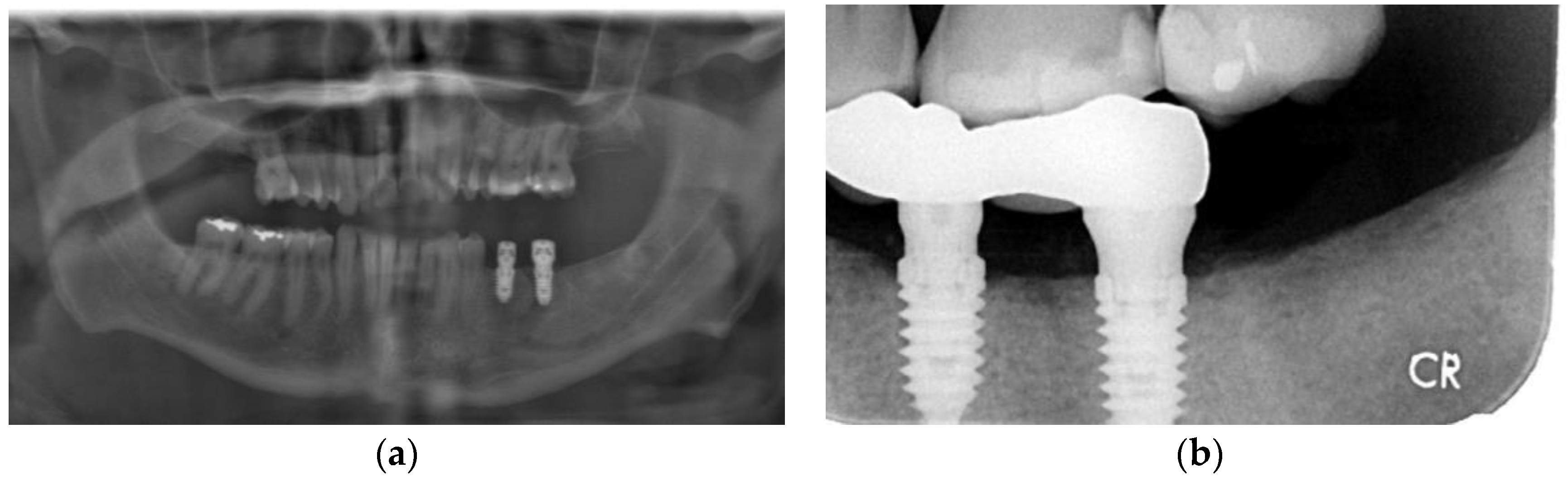Dentistry 11 00184 g003