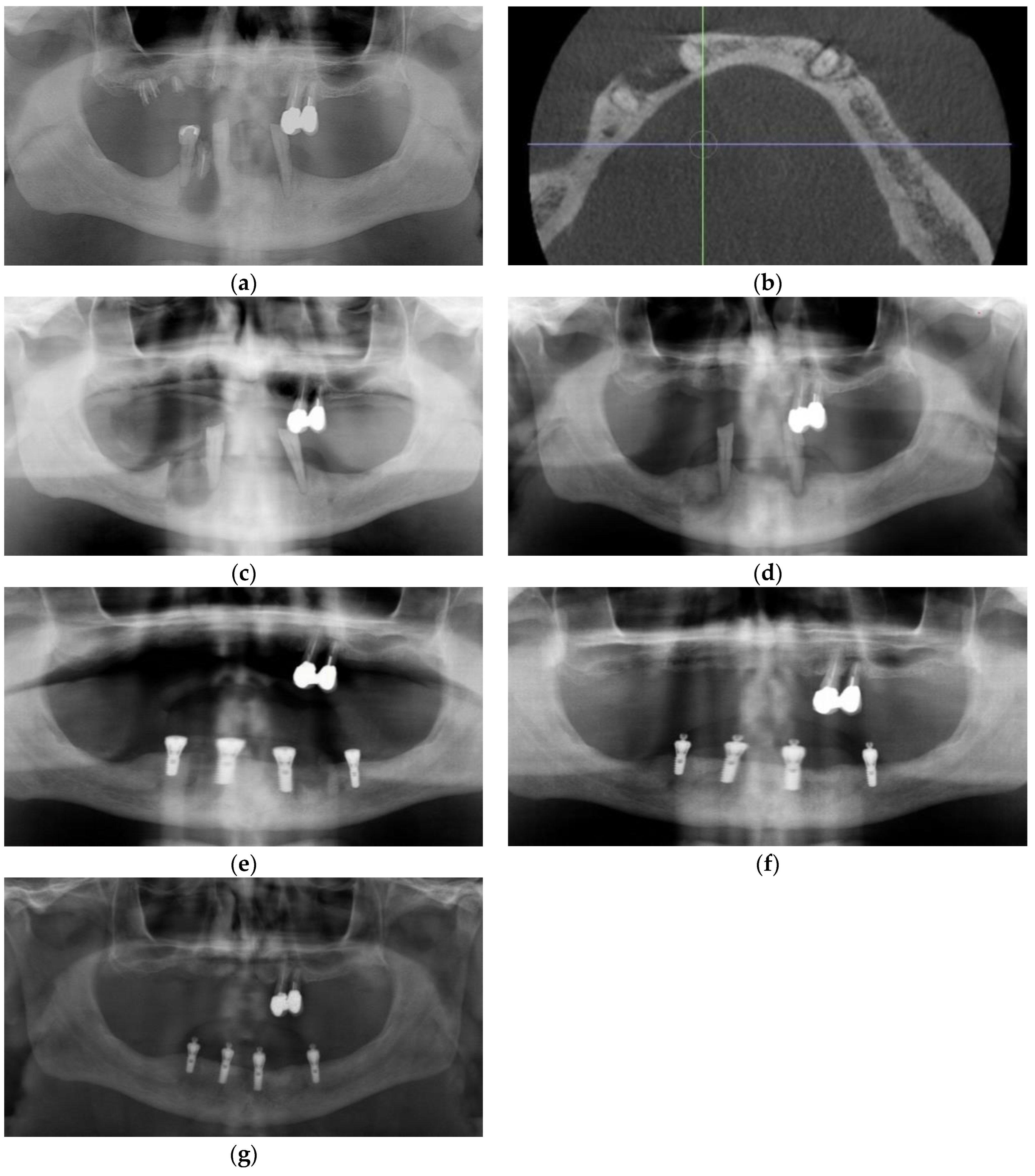 Dentistry 11 00184 g004