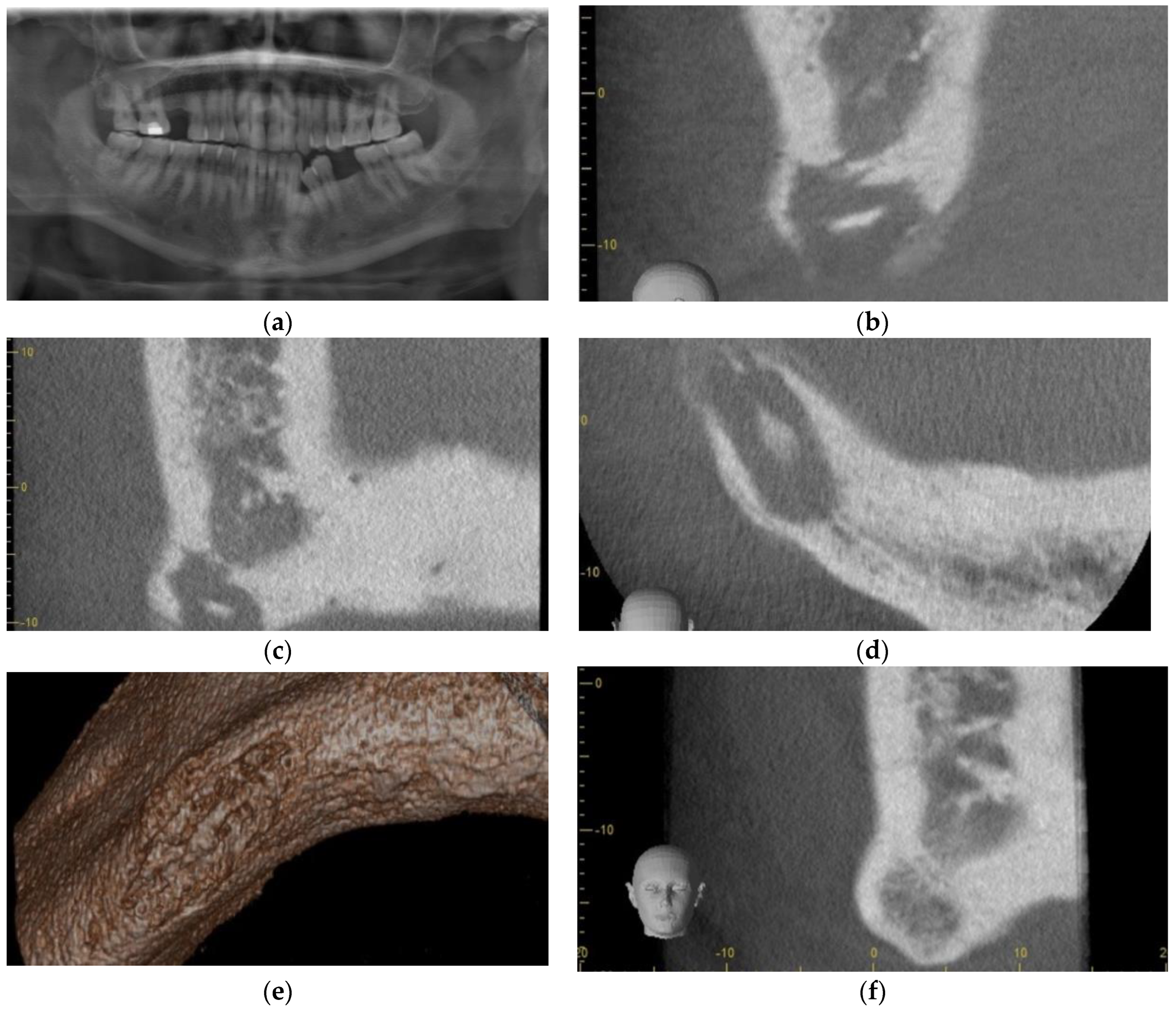 Dentistry 11 00184 g005