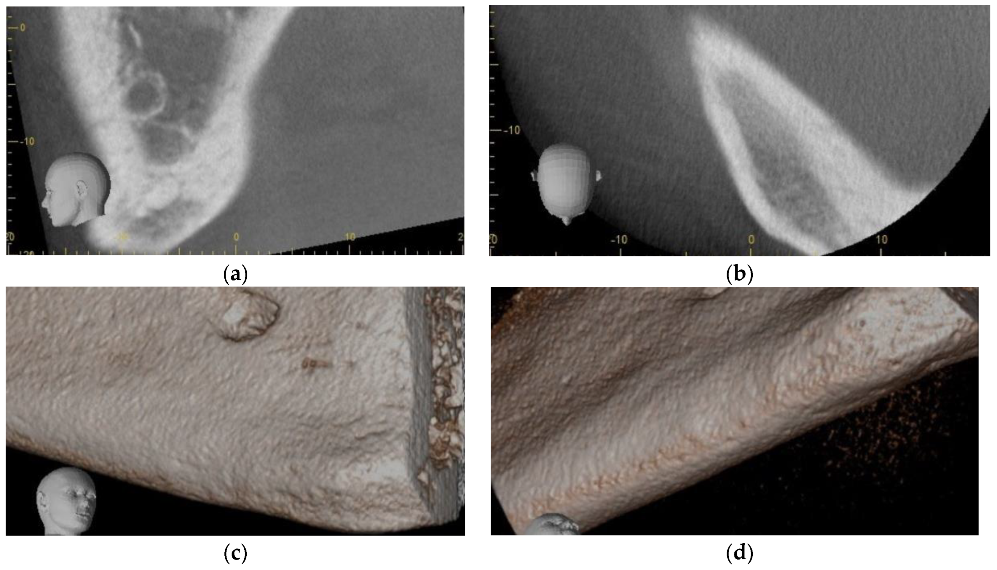 Dentistry 11 00184 g006