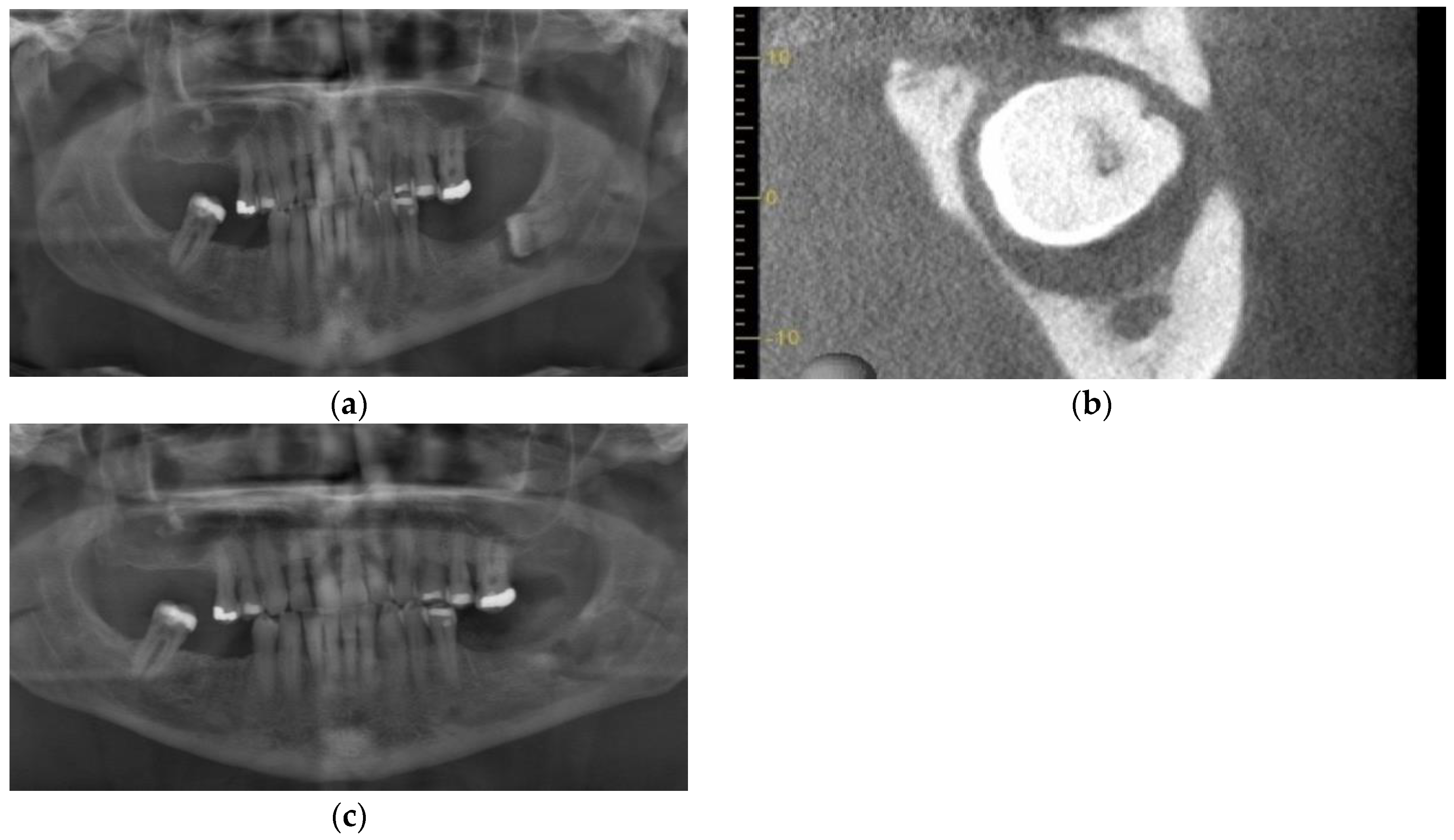 Dentistry 11 00184 g007