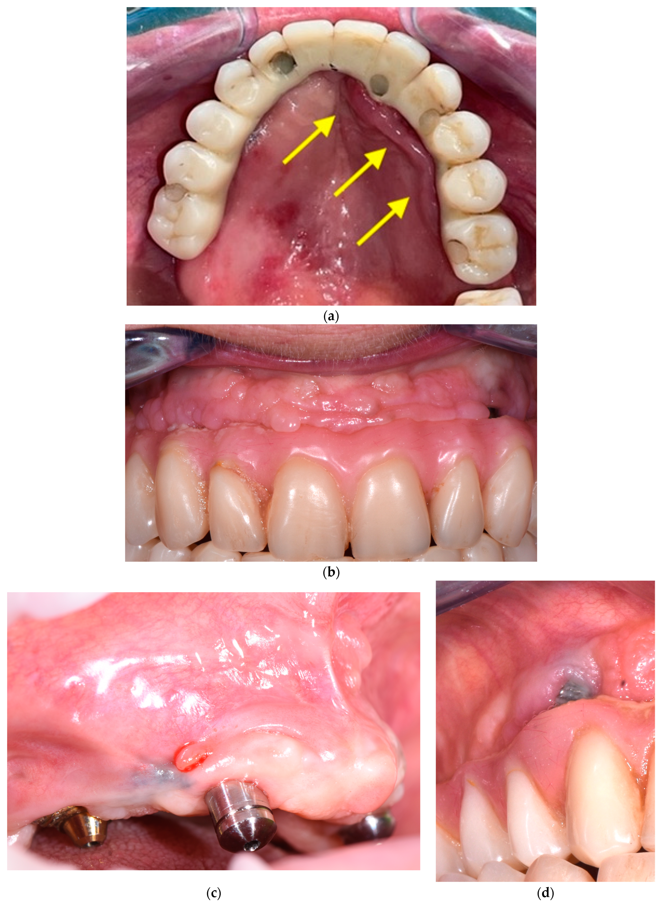 Dentistry 11 00226 g004