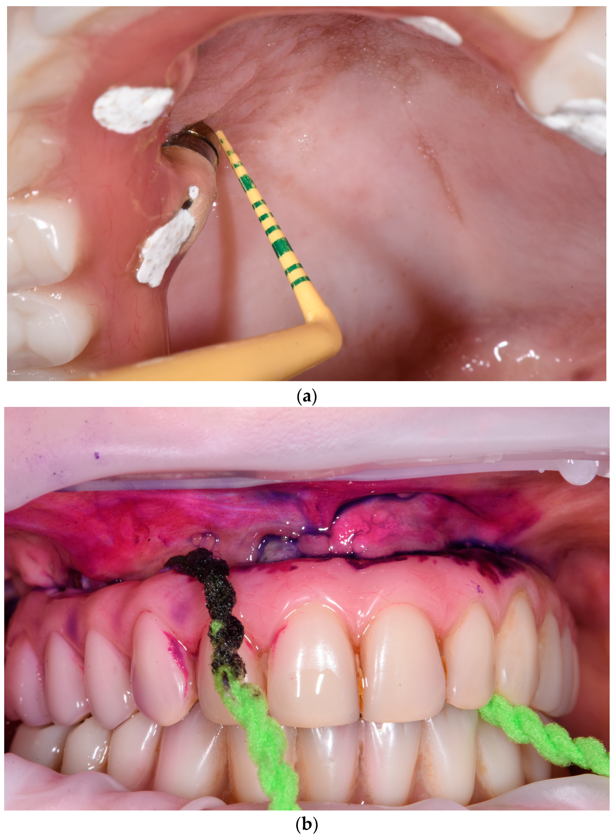 Dentistry 11 00226 g005