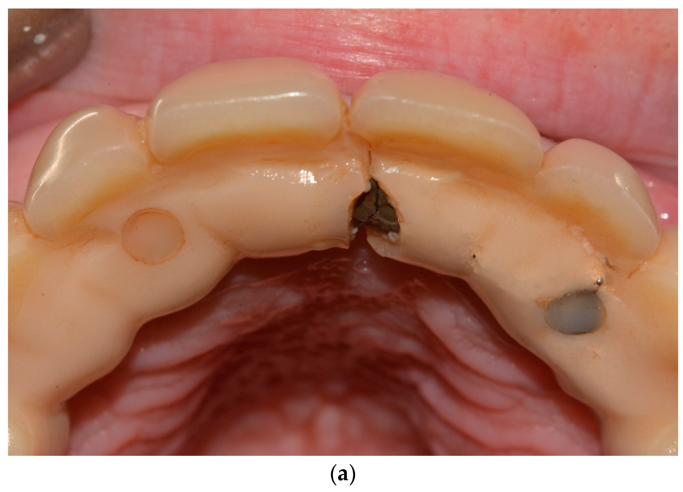 Dentistry 11 00226 g006a