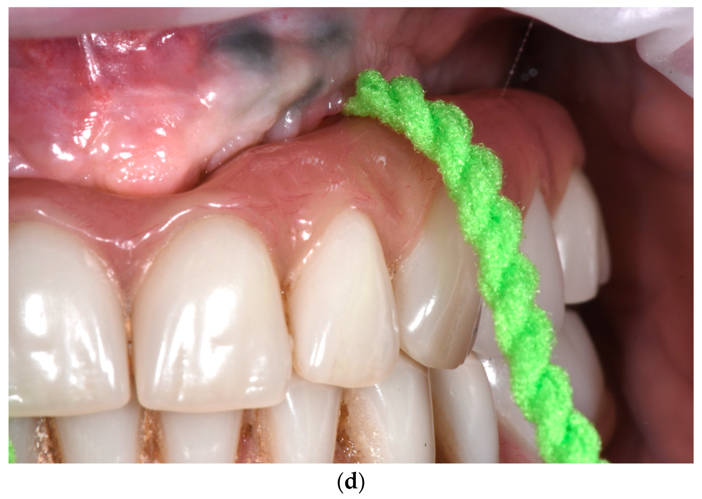 Dentistry 11 00226 g006c