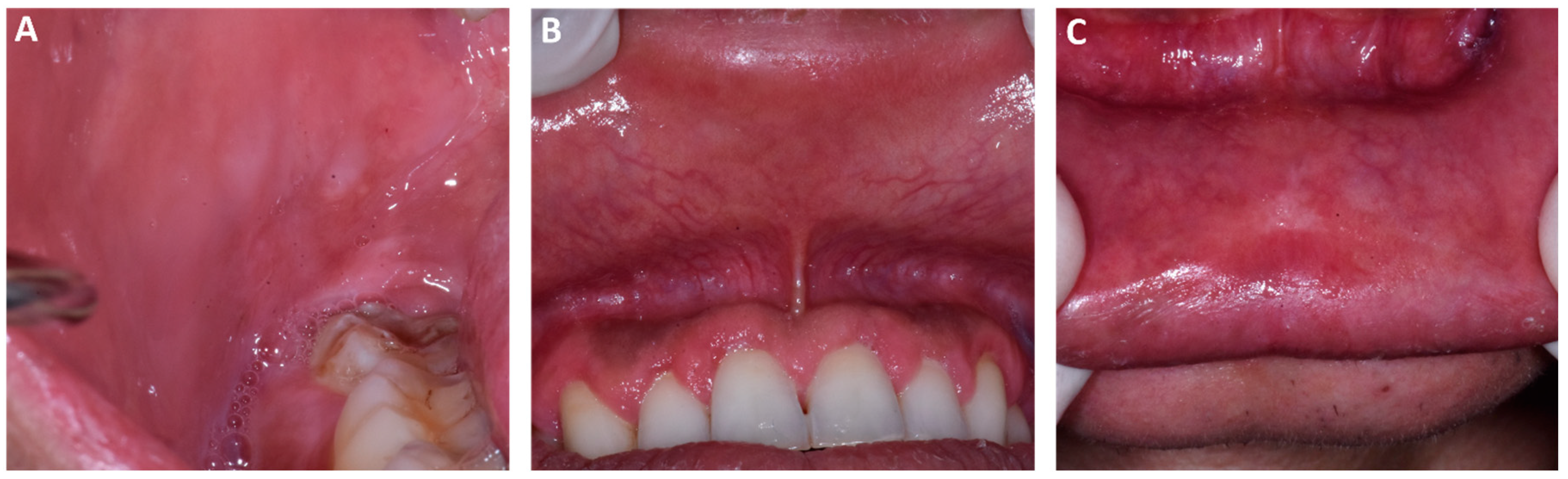 Dentistry 11 00231 g003 Dentistry 11 00231 g003