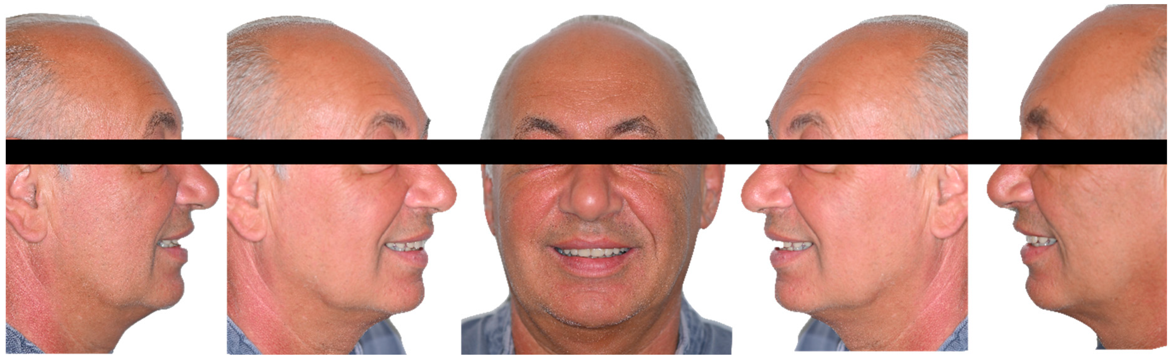 Dentistry 11 00256 g001