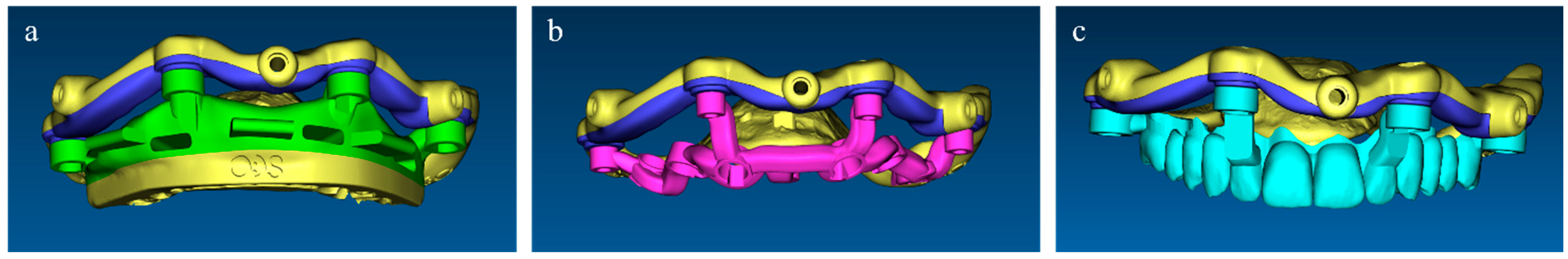 Dentistry 11 00256 g006