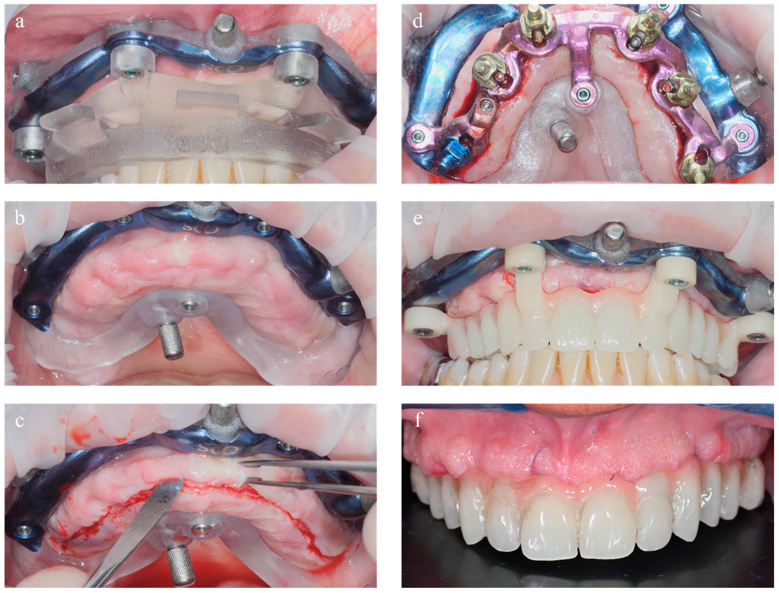 Dentistry 11 00256 g008