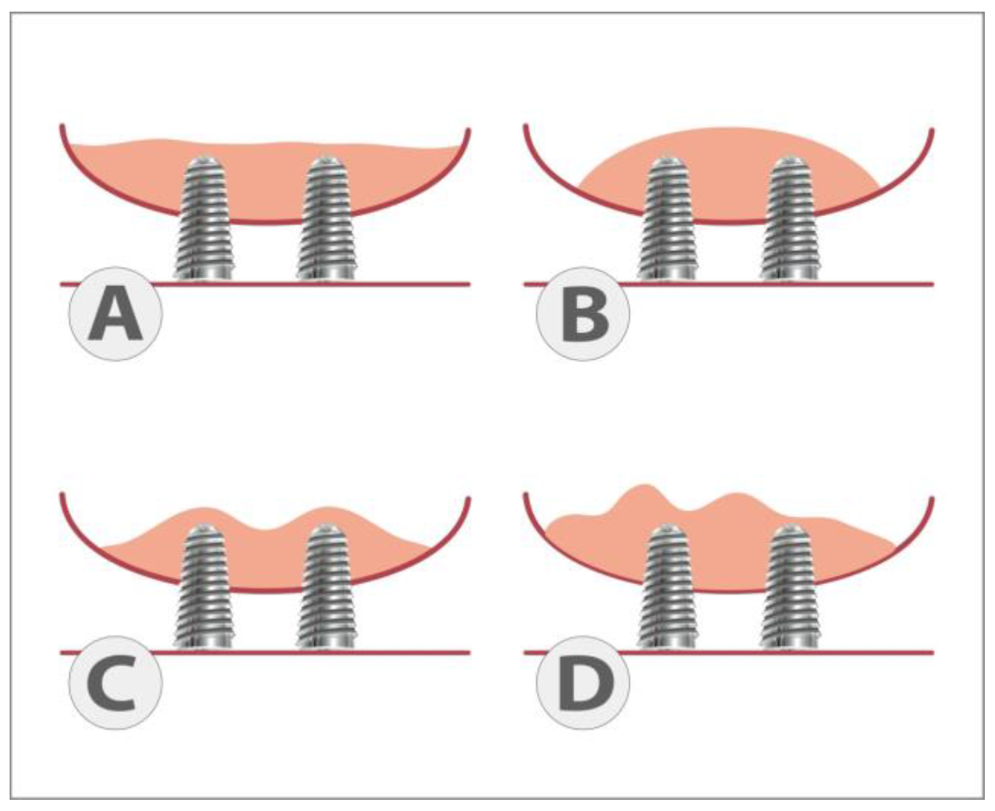 Dentistry 11 00273 g002