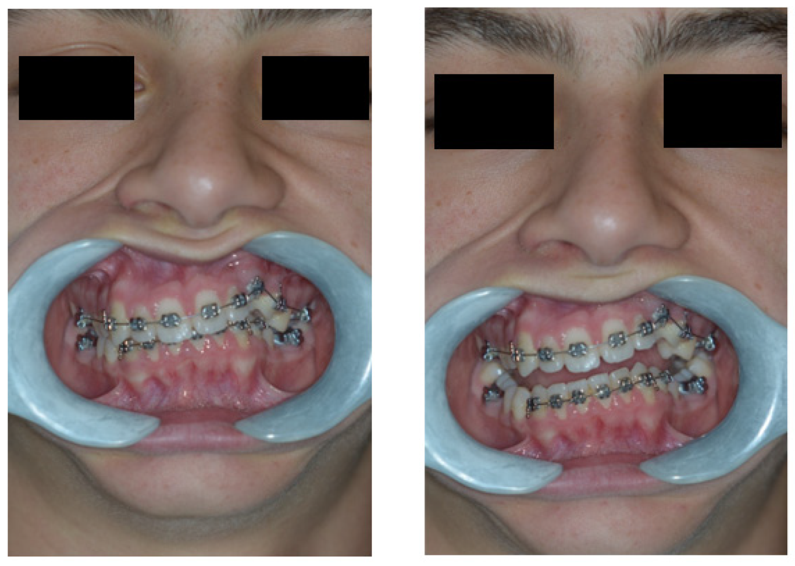 Dentistry 11 00278 g002