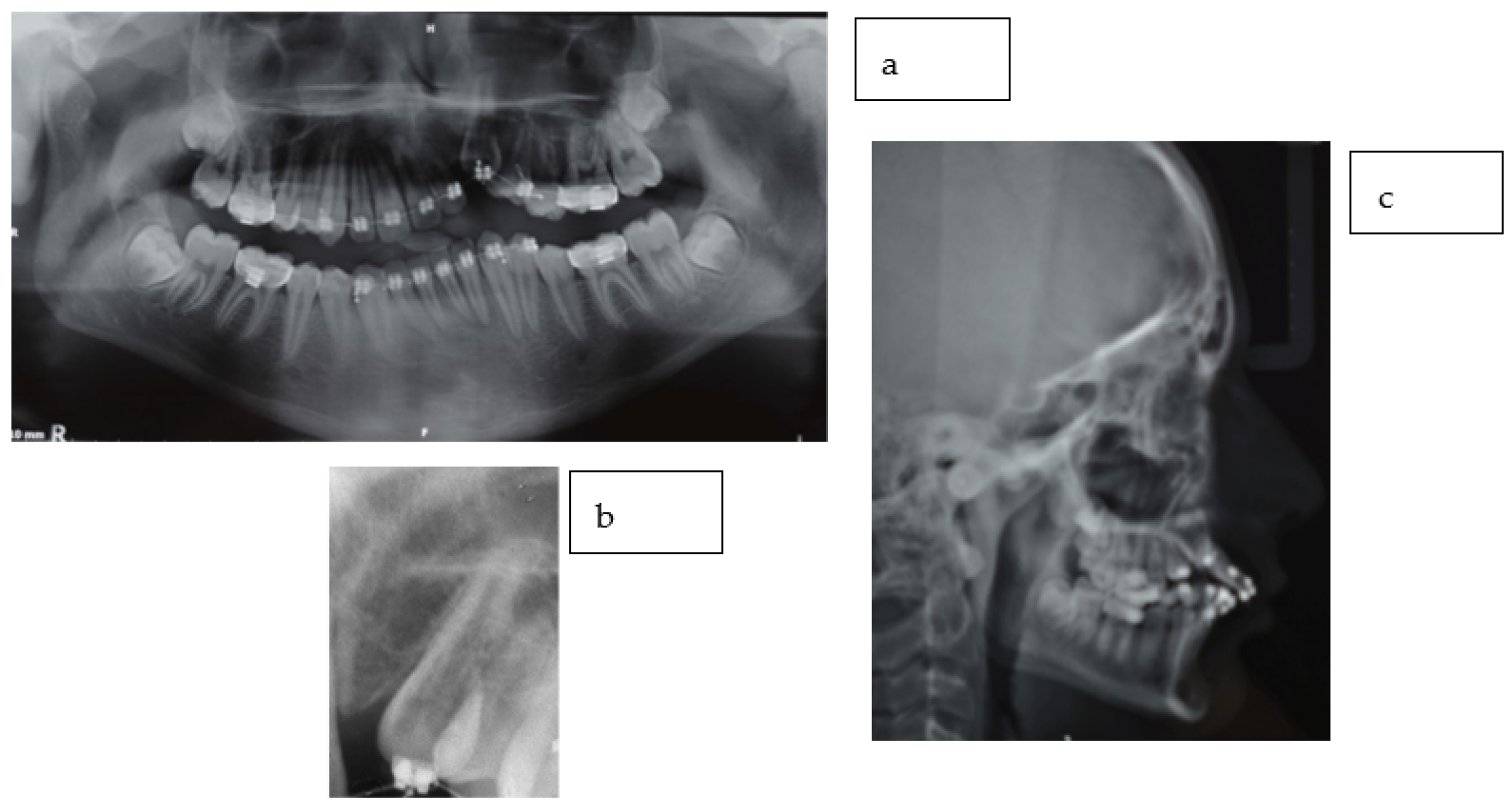Dentistry 11 00278 g003